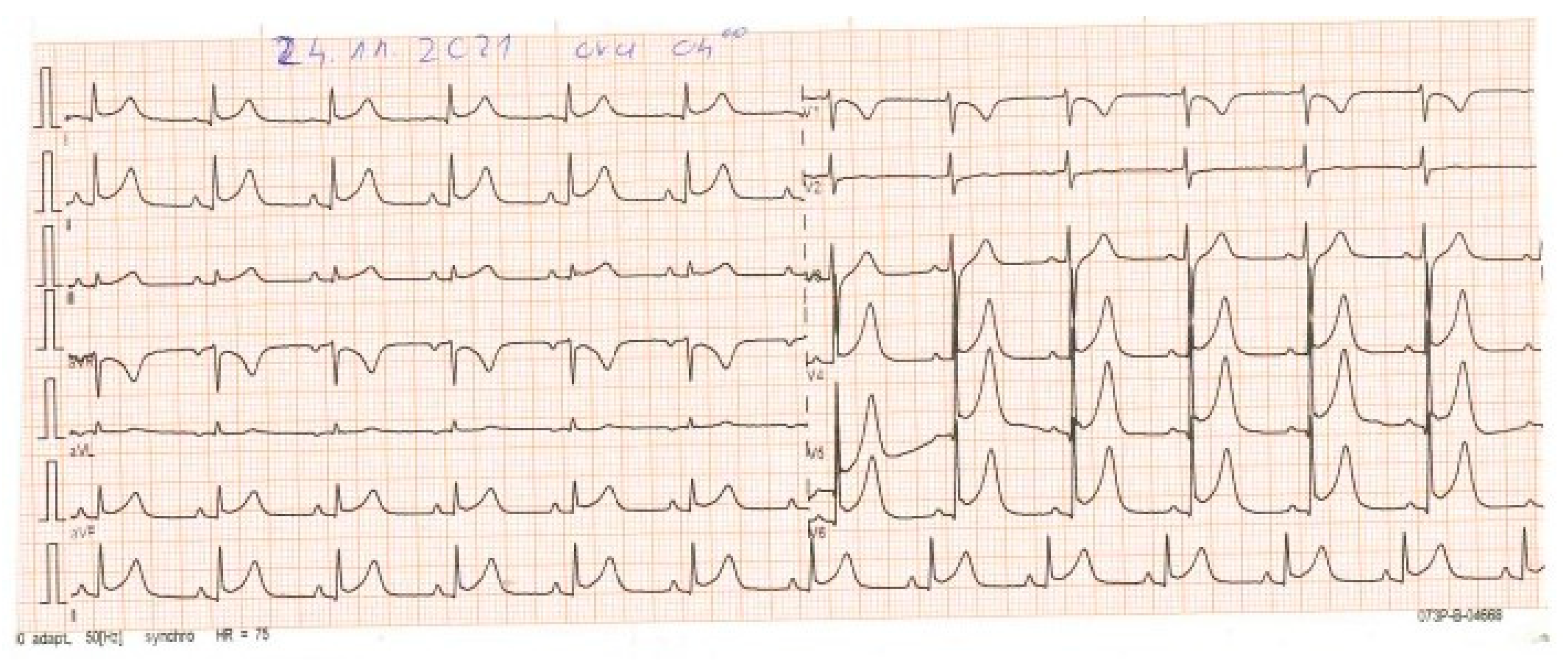 Vaccines 11 00956 g003