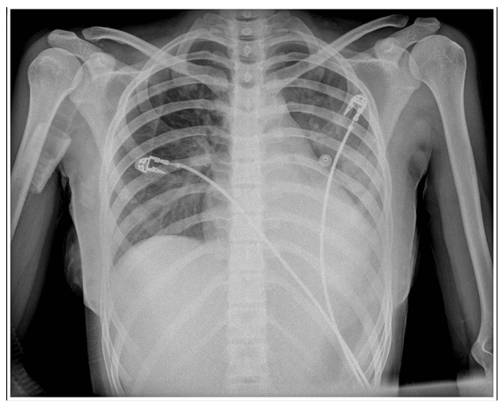 Vaccines 11 00956 g004