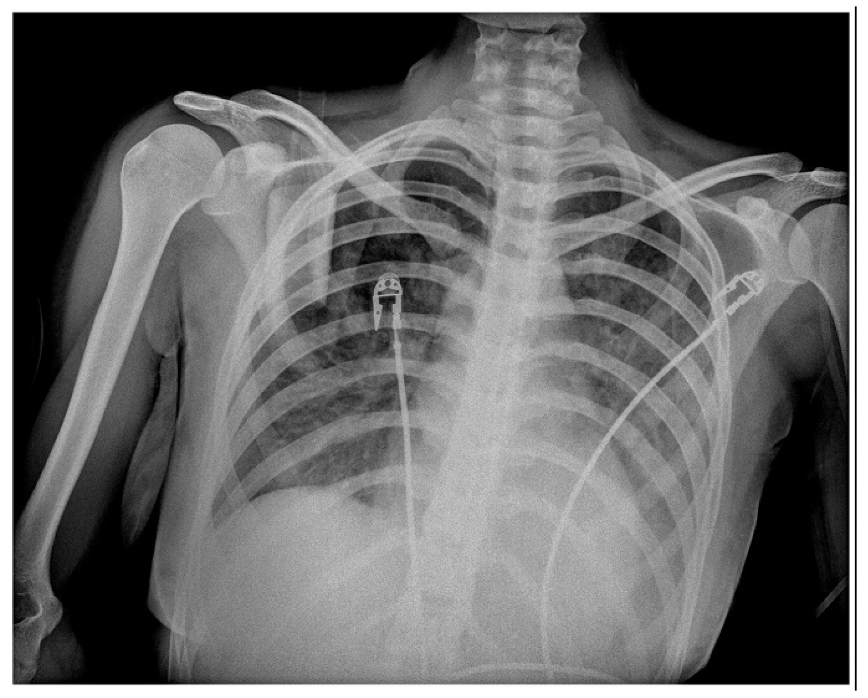 Vaccines 11 00956 g005