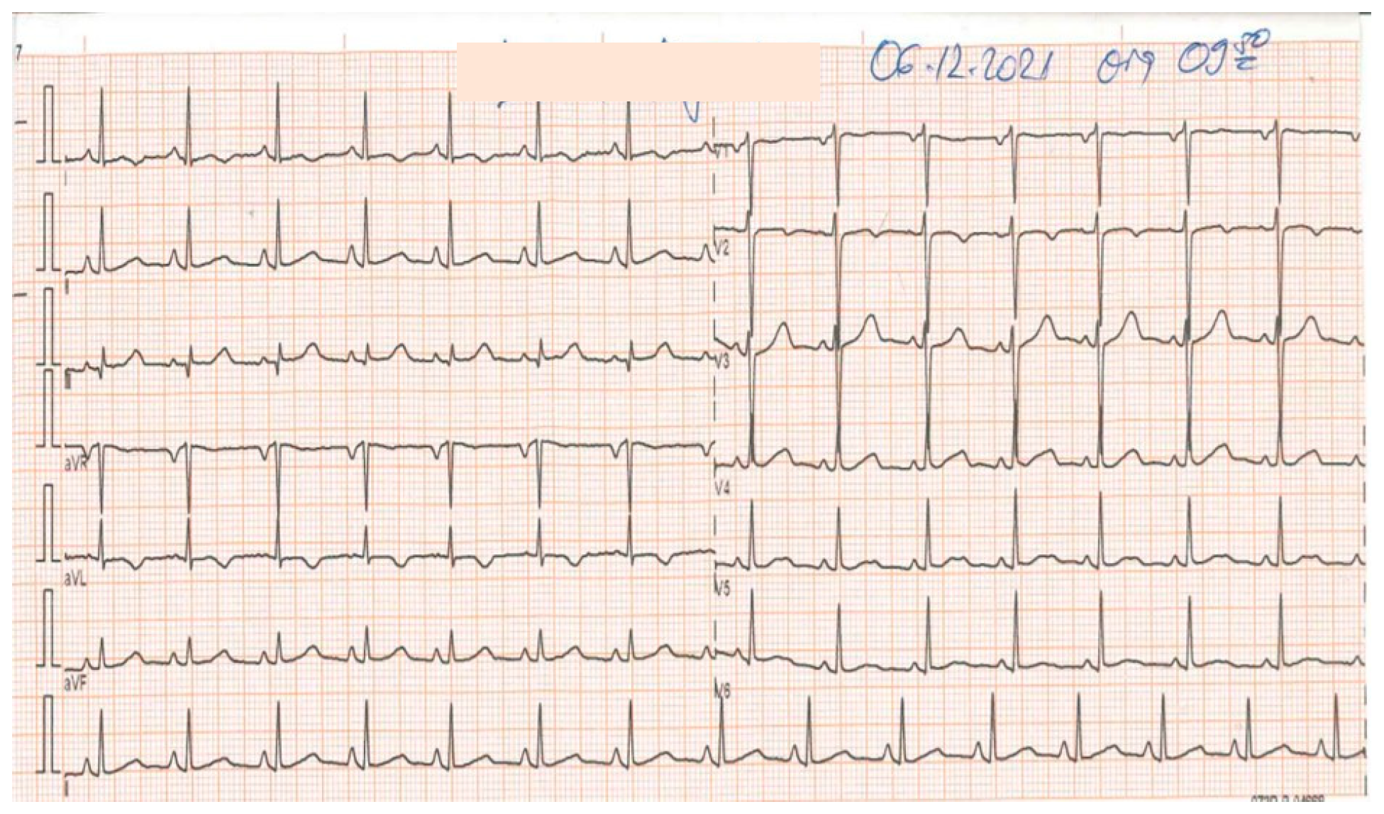 Vaccines 11 00956 g006