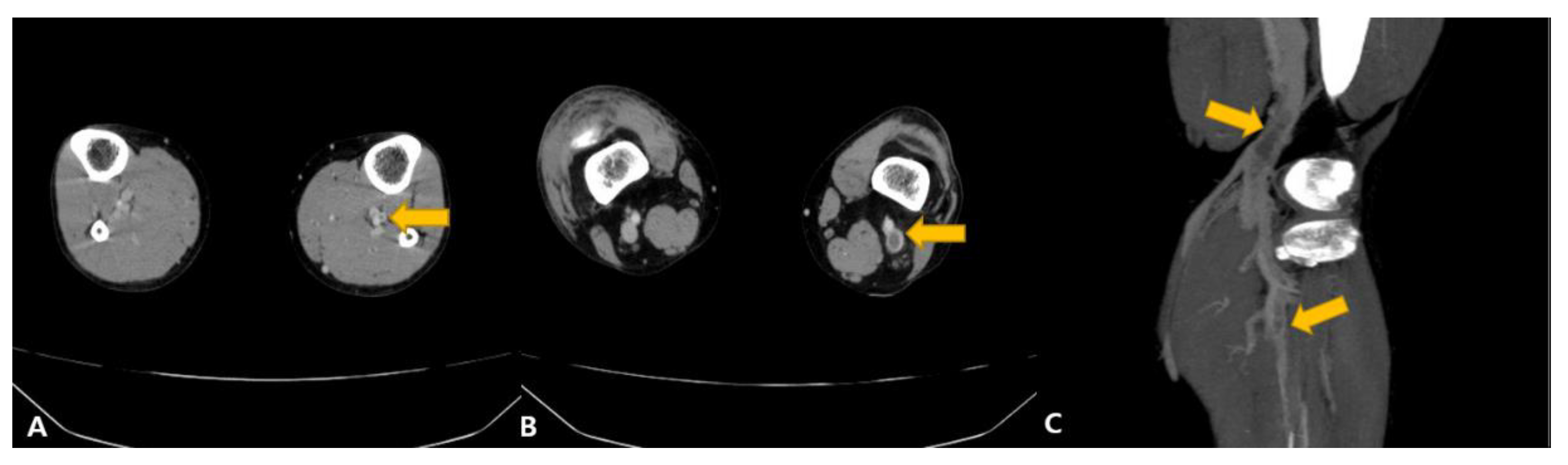 Vaccines 11 01075 g002 550