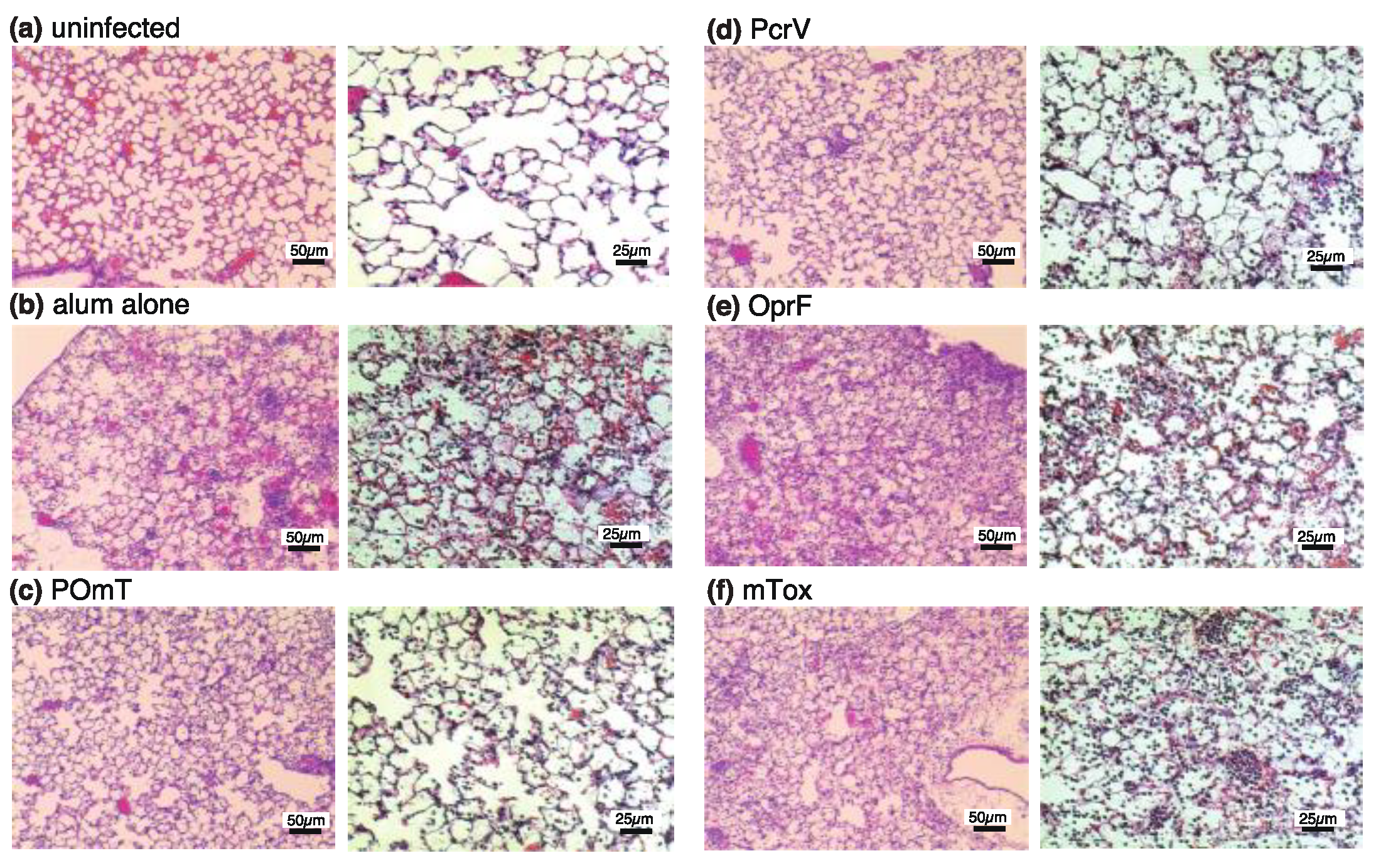 Vaccines 11 01088 g007