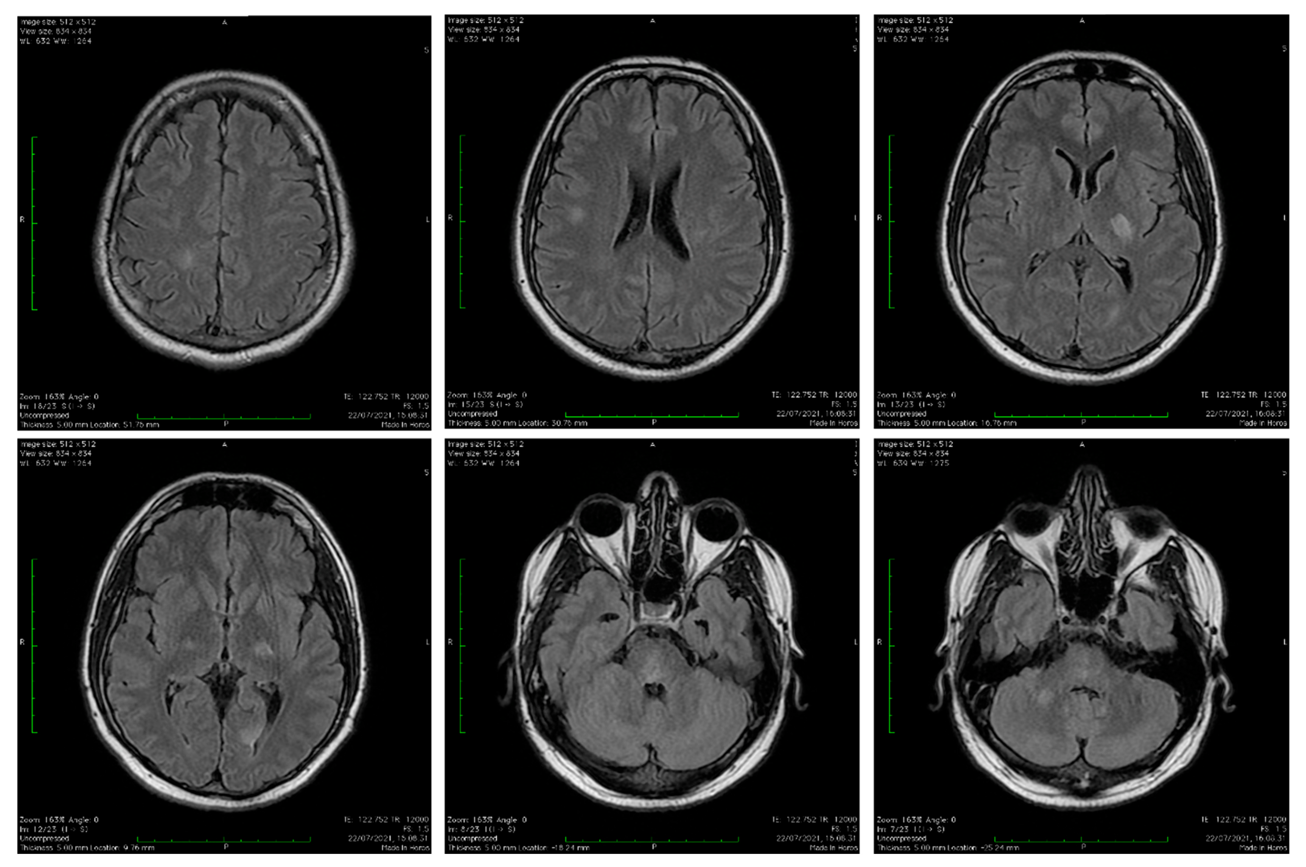 Vaccines 11 01225 g003 Vaccines 11 01225 g003