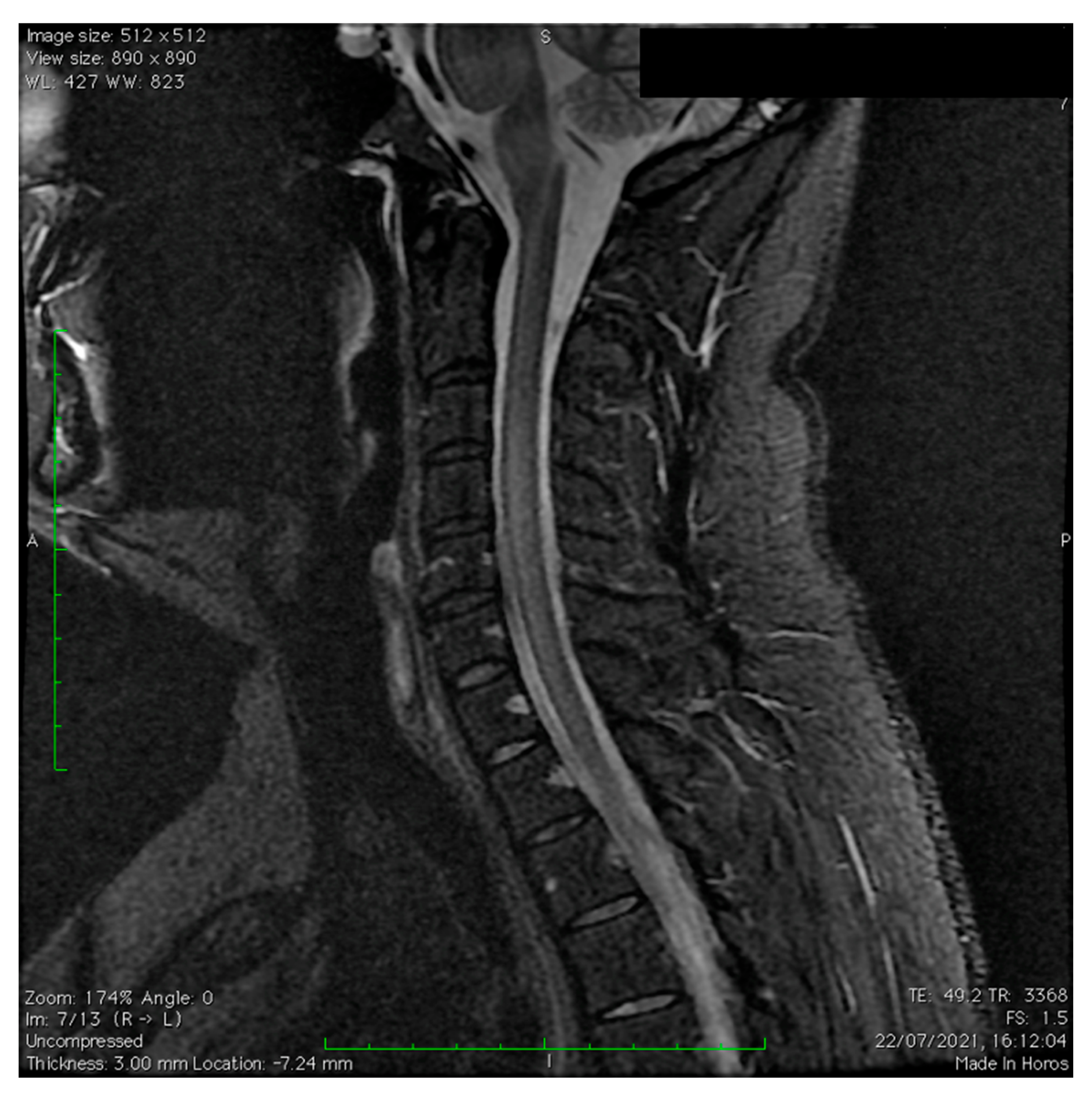 Vaccines 11 01225 g004 Vaccines 11 01225 g004