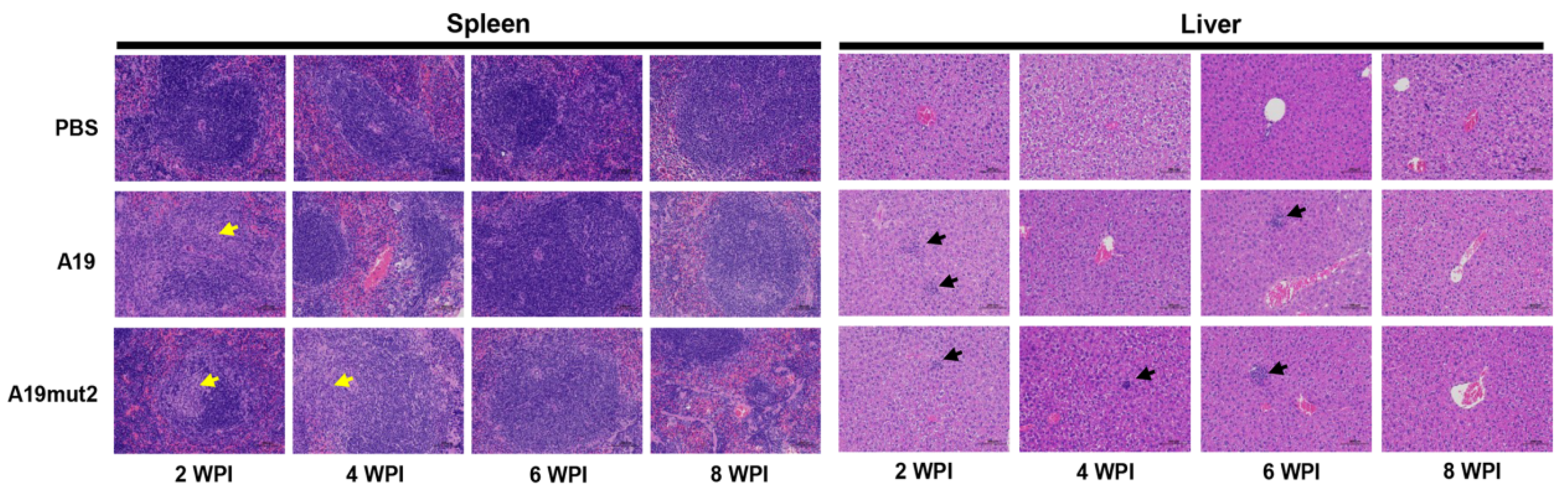 Vaccines 11 01273 g004