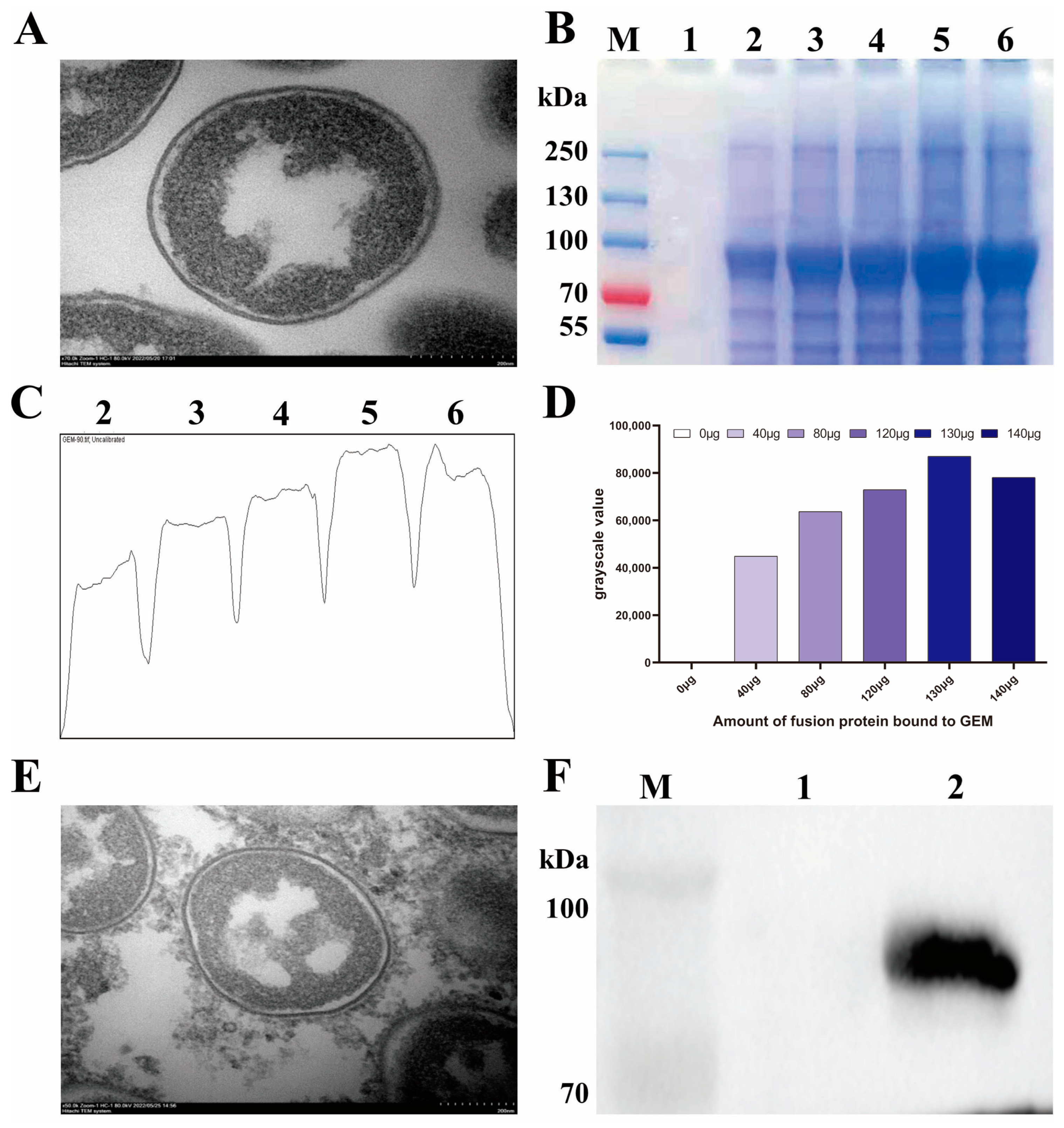 Vaccines 11 01292 g003 Vaccines 11 01292 g003