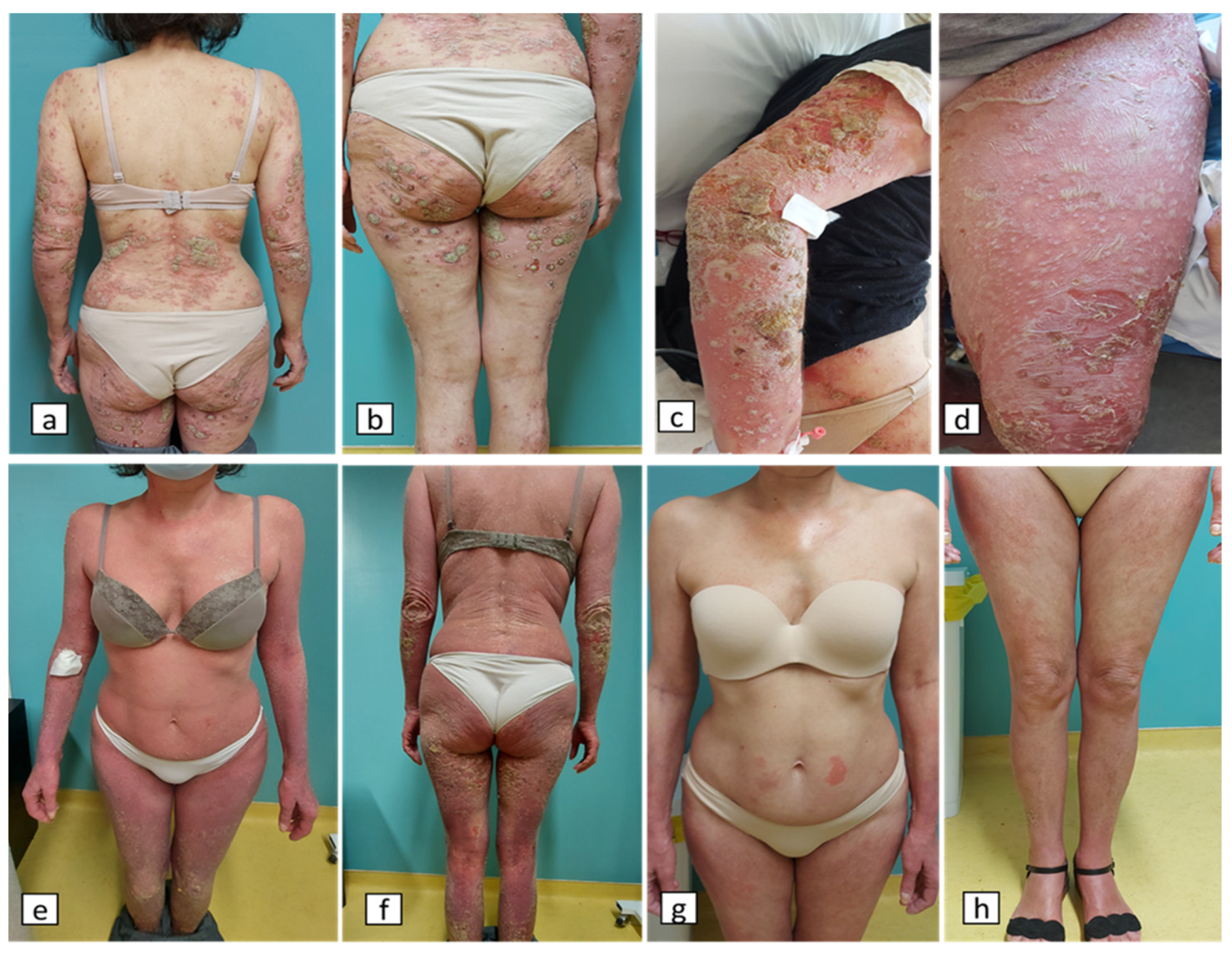 Vaccines 11 01298 g001