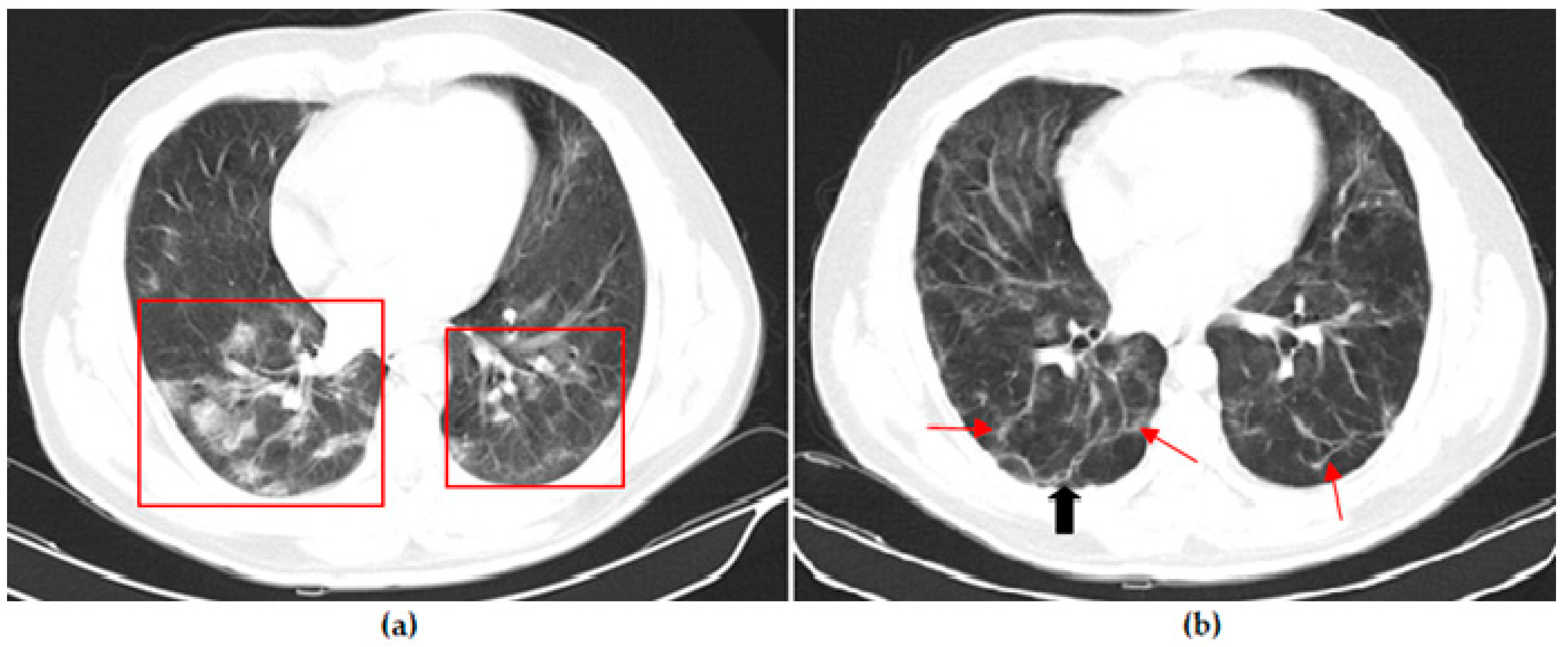Vaccines 11 01321 g002