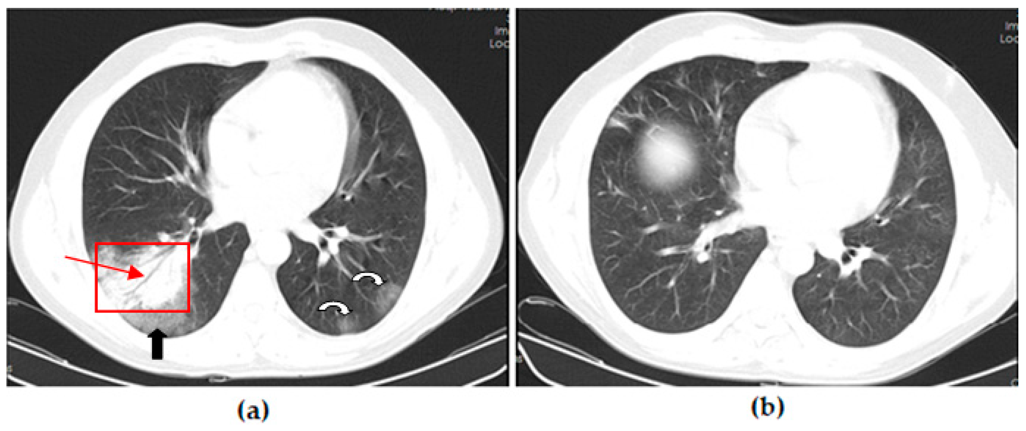 Vaccines 11 01321 g003