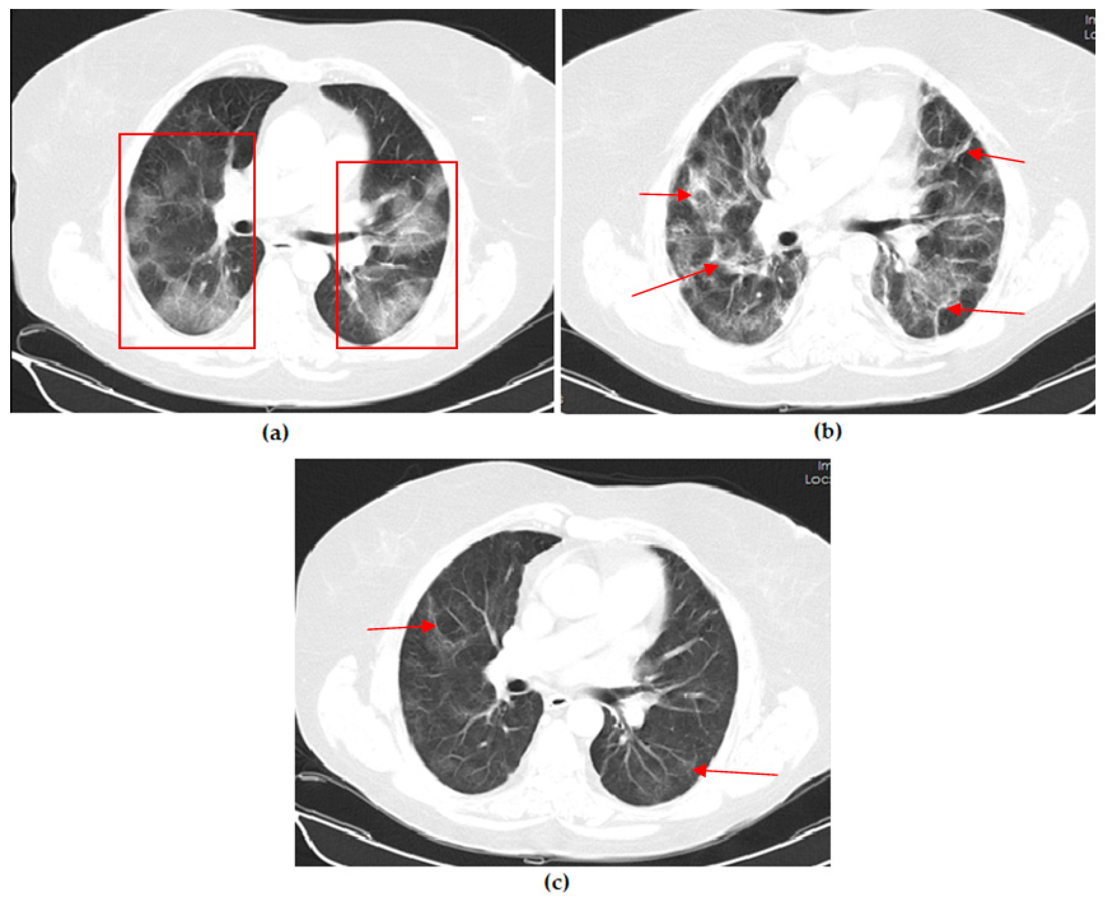 Vaccines 11 01321 g005