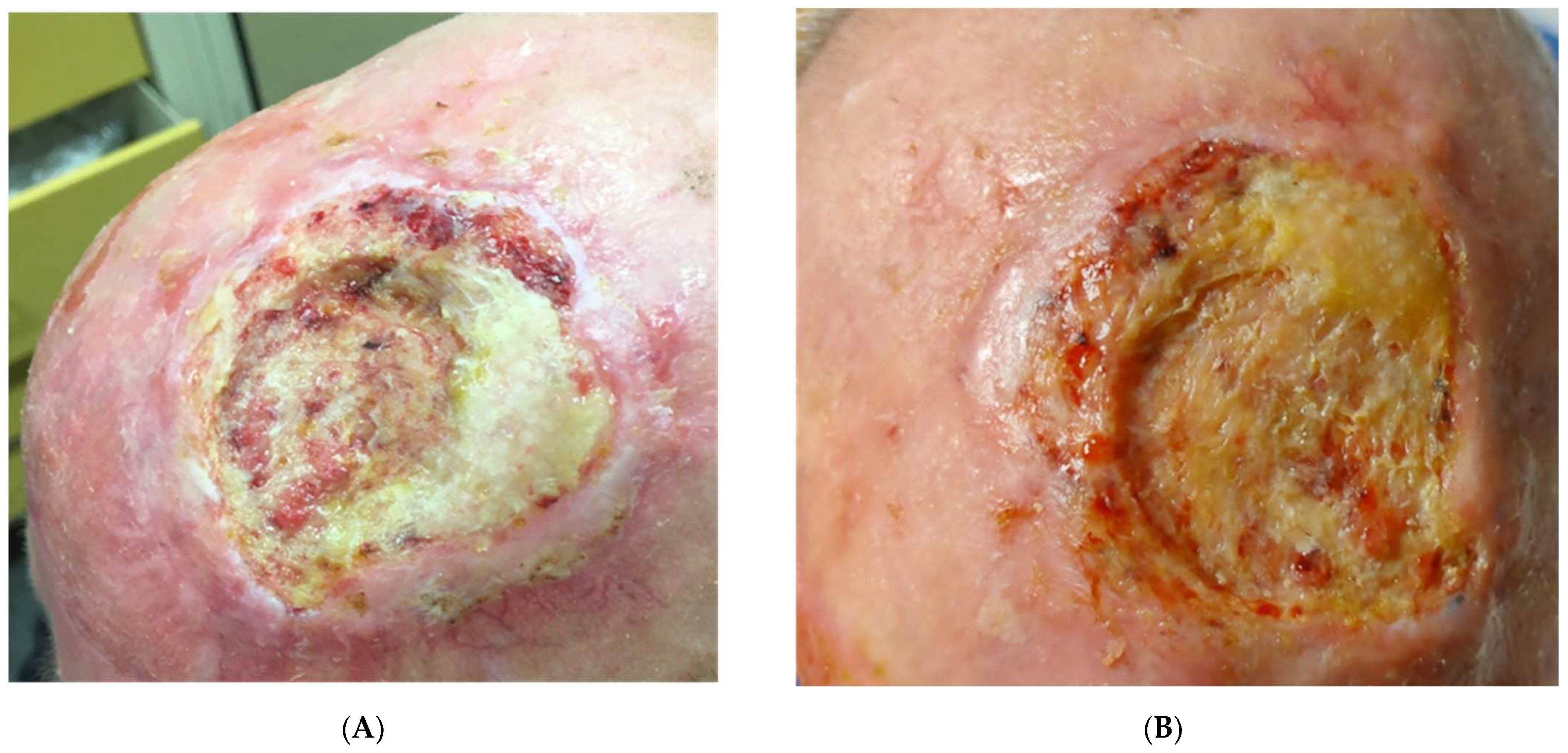 Vaccines 11 01500 g001