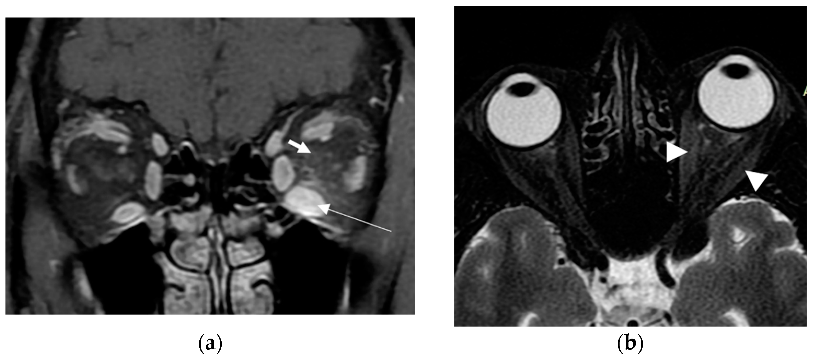 Vaccines 11 01574 g001