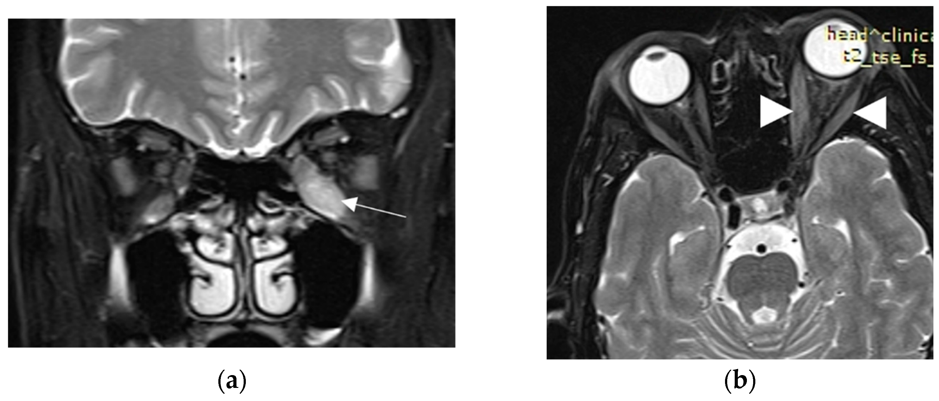 Vaccines 11 01574 g002