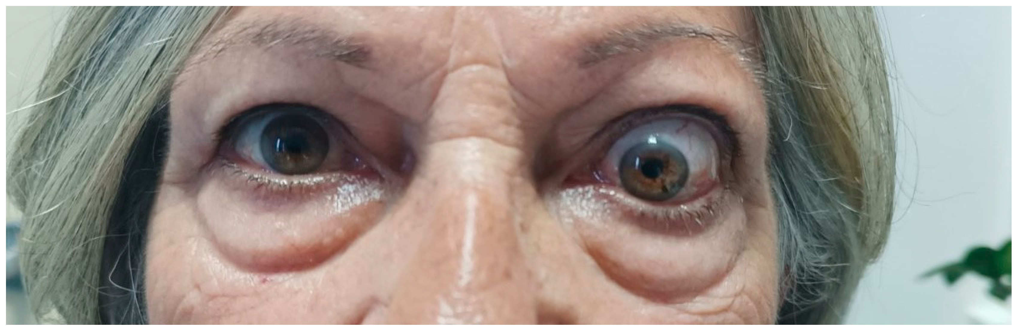 Vaccines 11 01574 g003