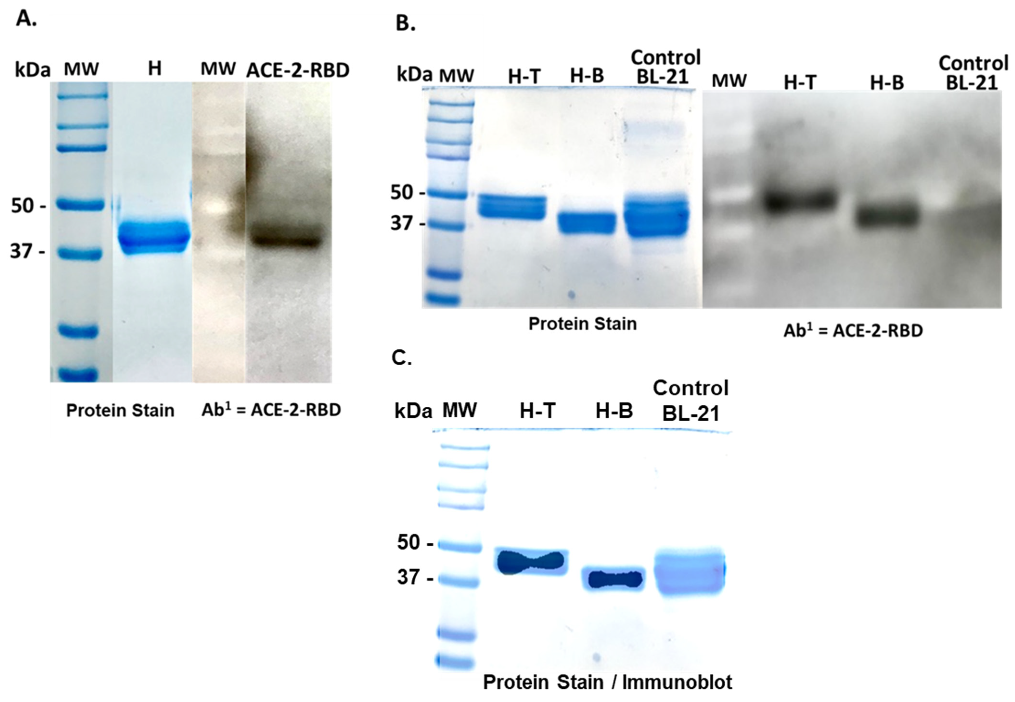 Vaccines | free full-text | a ctb-sars-cov-2-ace-2 rbd mucosal vaccine