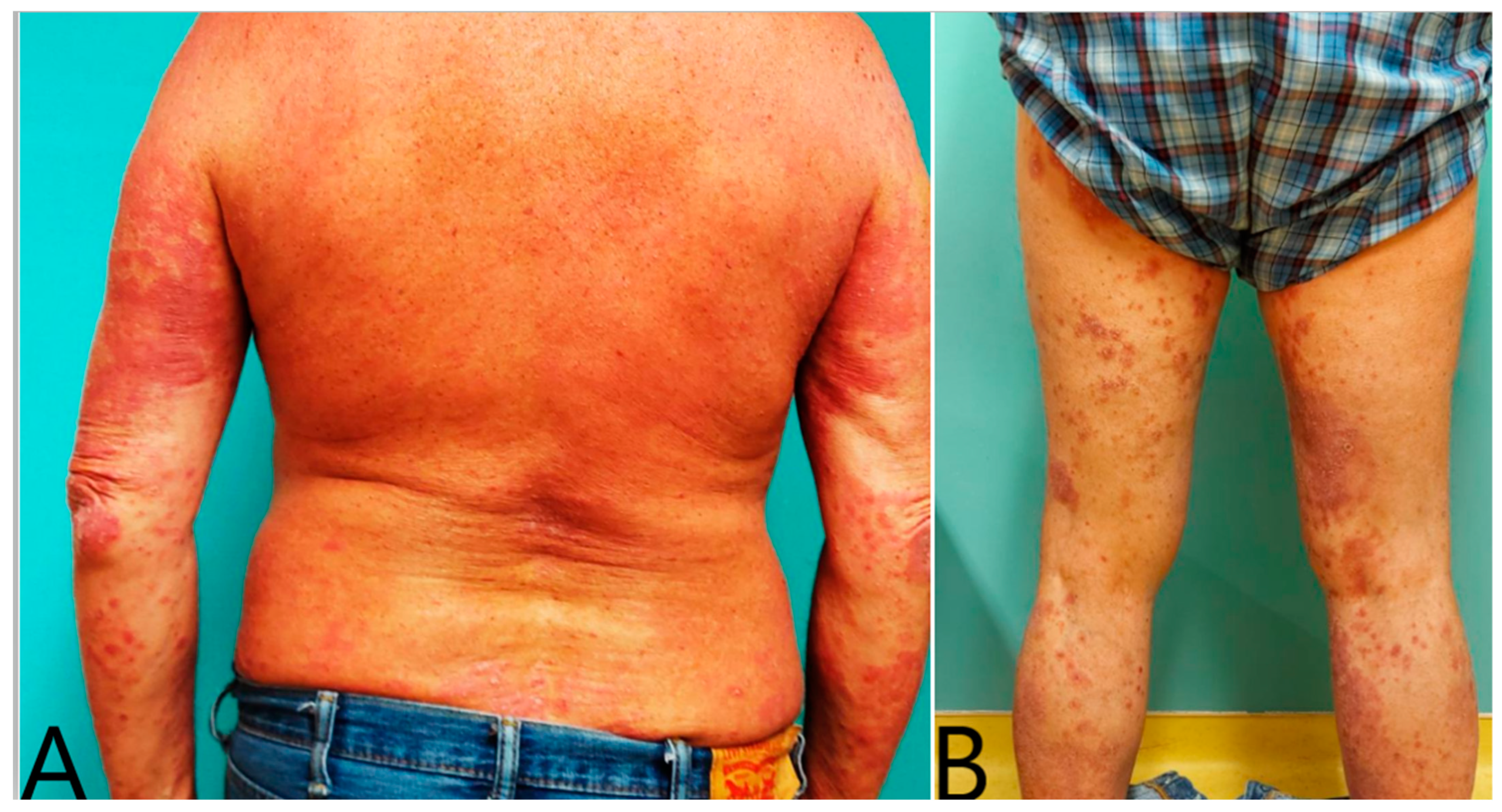 Vaccines 12 00178 g001