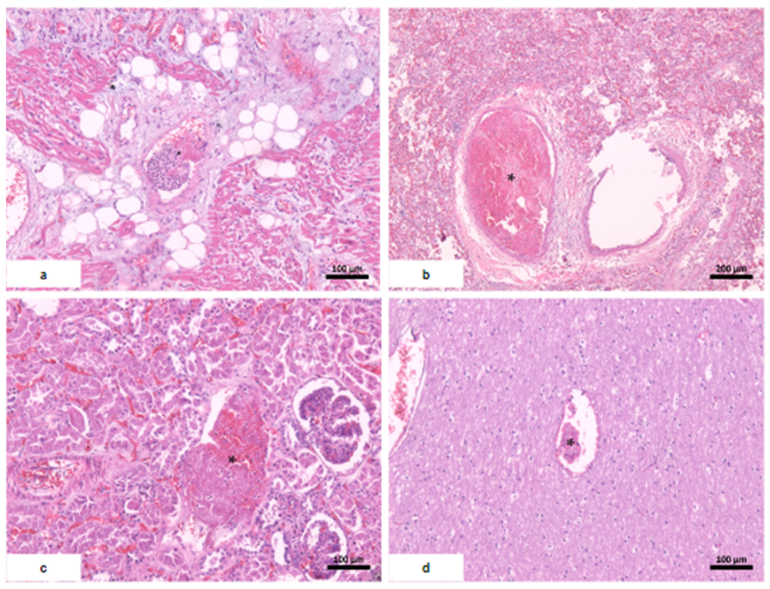 Vaccines 12 00194 g004