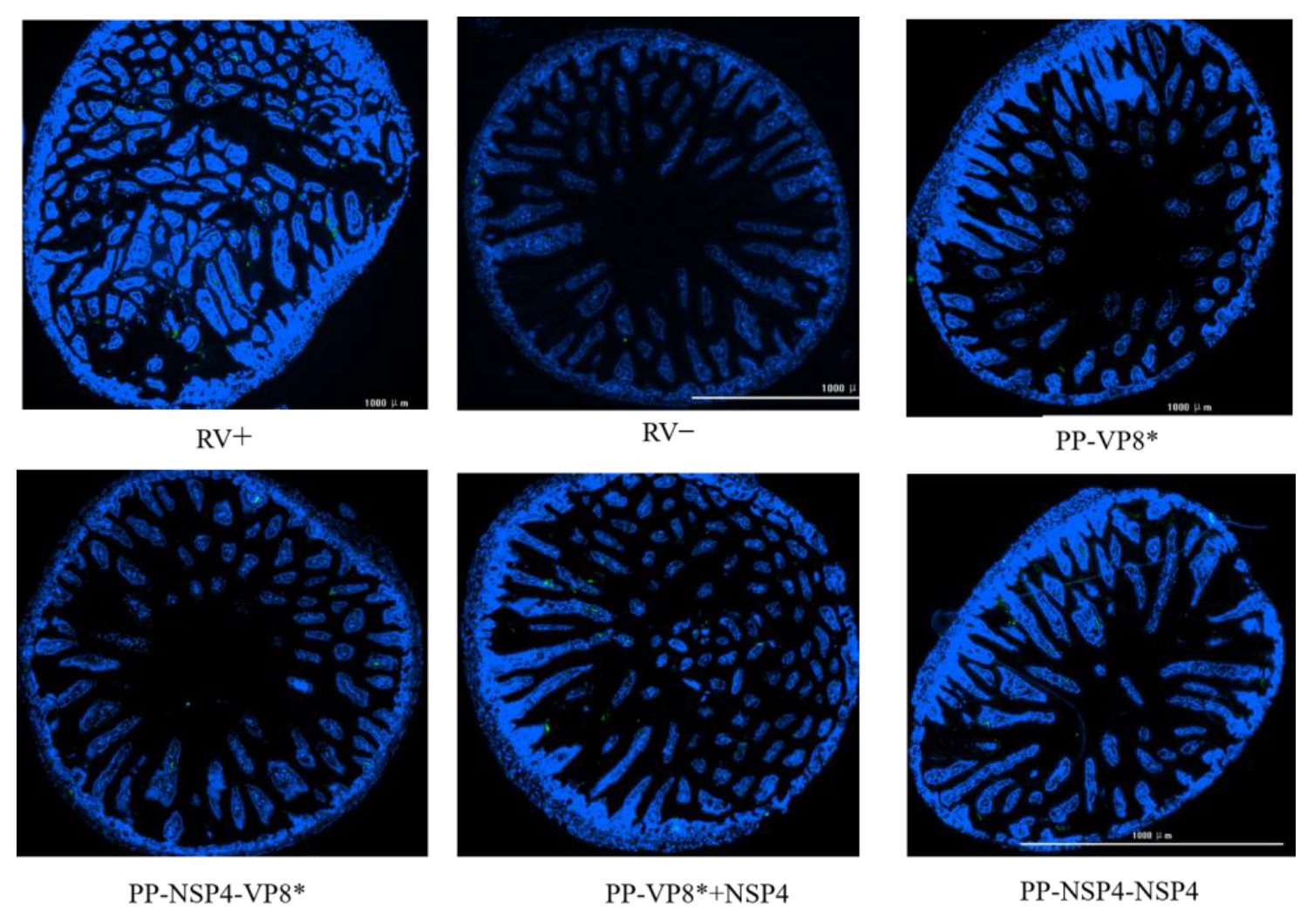 Vaccines 12 01025 g008 Vaccines 12 01025 g008