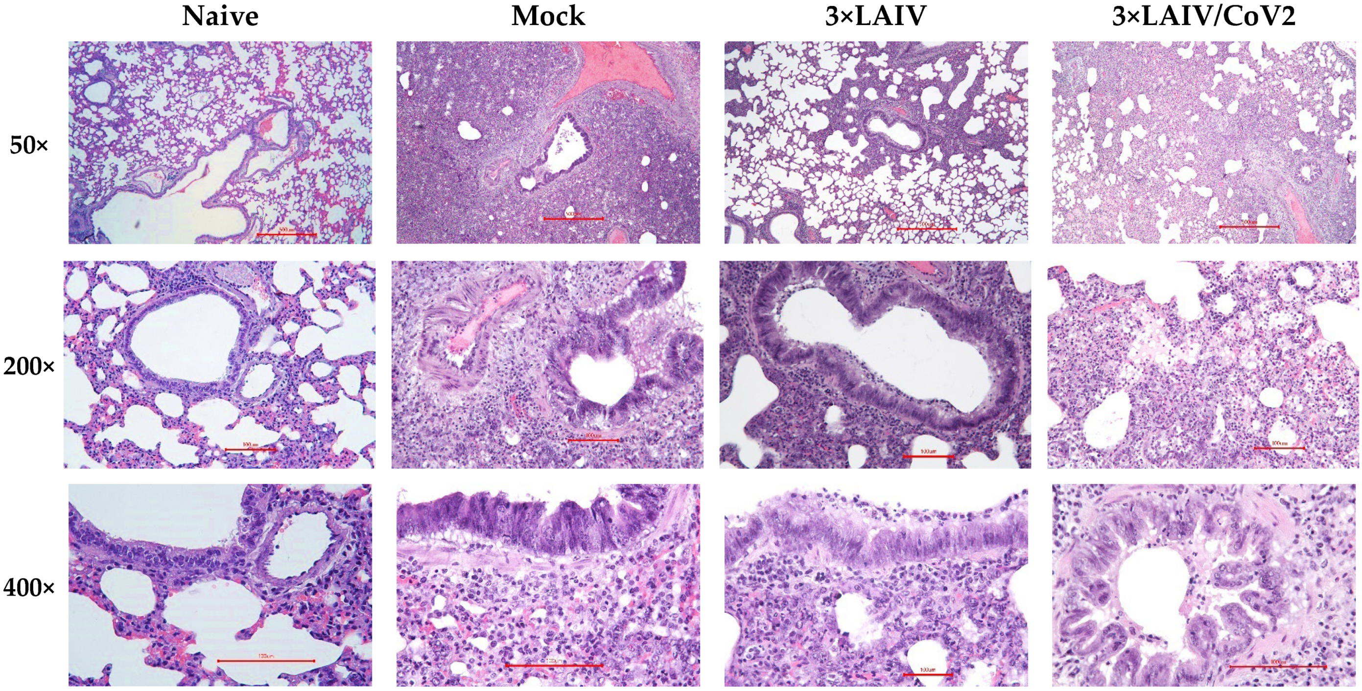 Vaccines 12 01300 g007