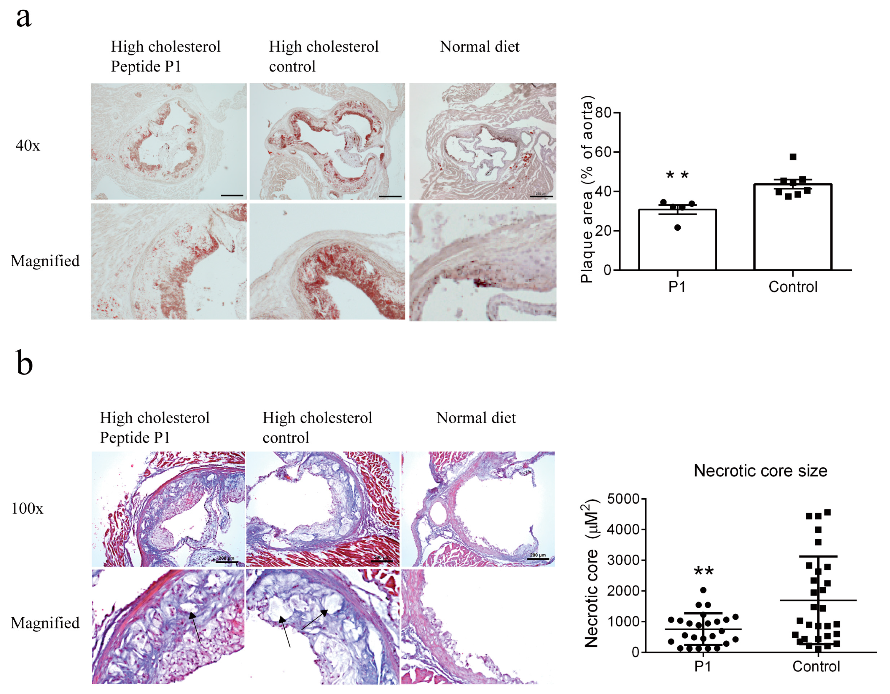 Vaccines 13 00241 g004