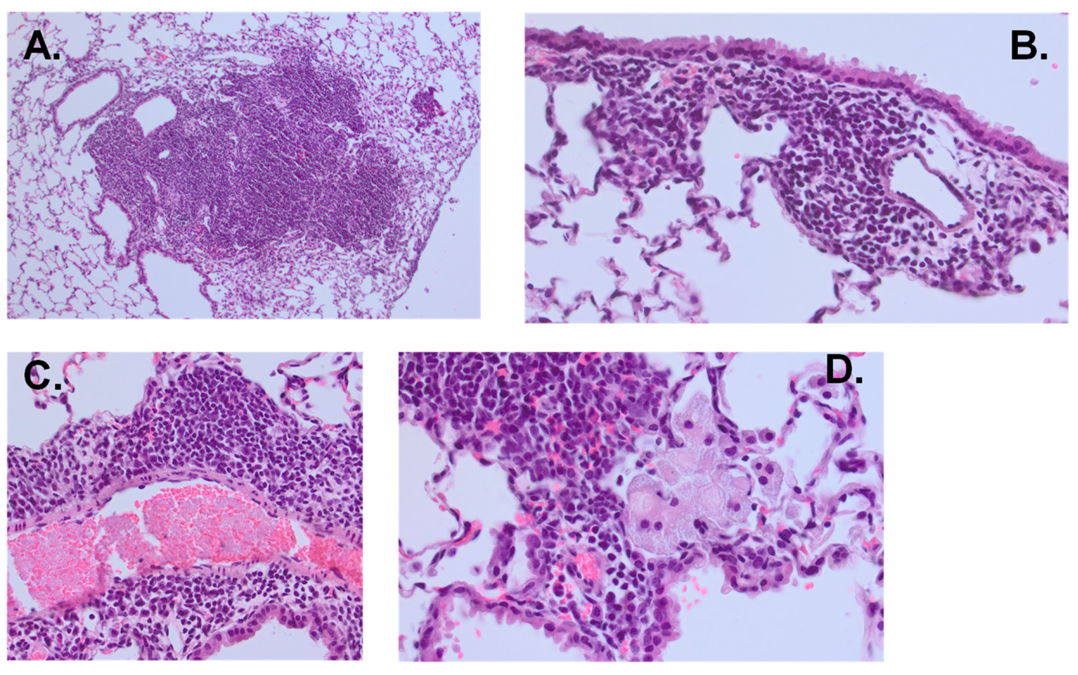 Vaccines 13 00619 g006 Vaccines 13 00619 g006