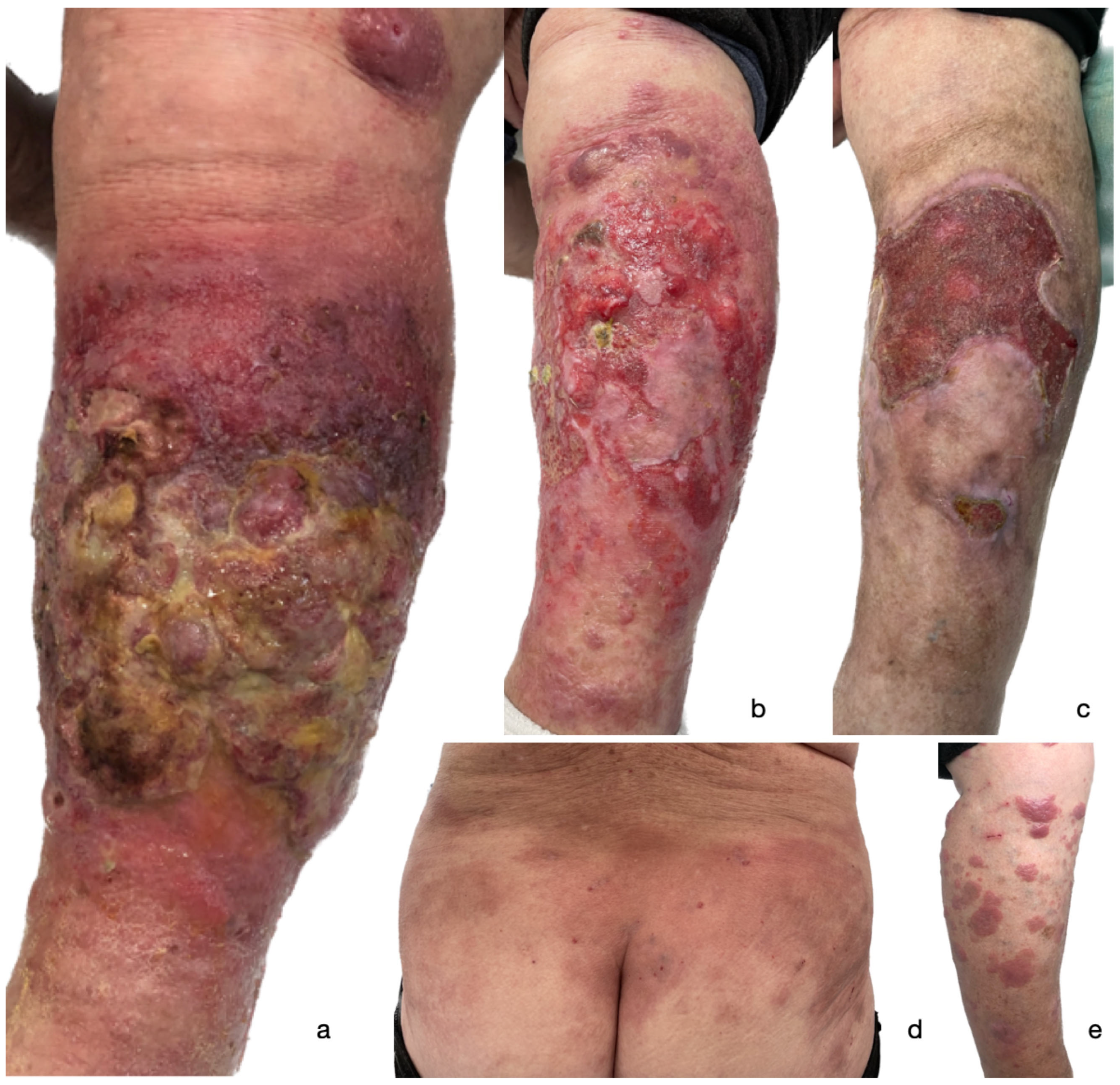 Vaccines 13 00678 g001