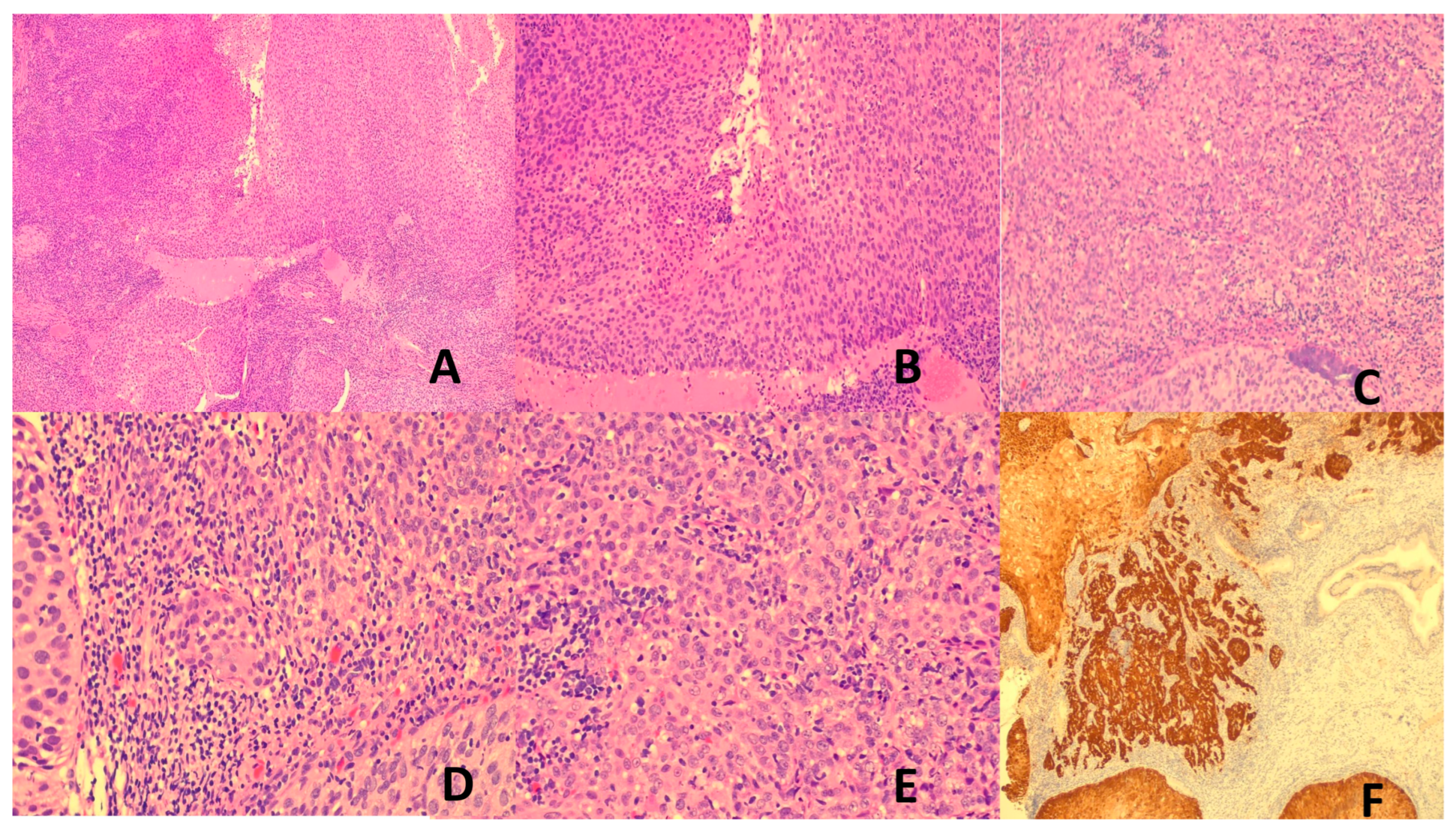 Vaccines 13 00911 g001 Vaccines 13 00911 g001