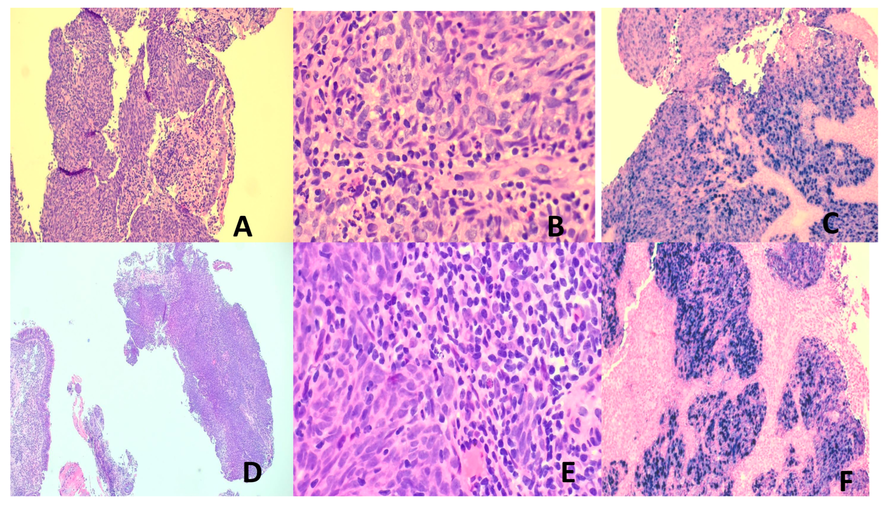 Vaccines 13 00911 g002 Vaccines 13 00911 g002