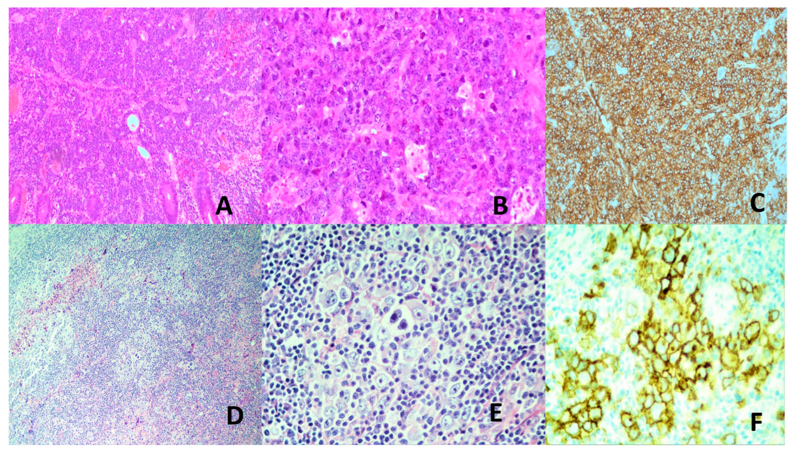 Vaccines 13 00911 g003 Vaccines 13 00911 g003