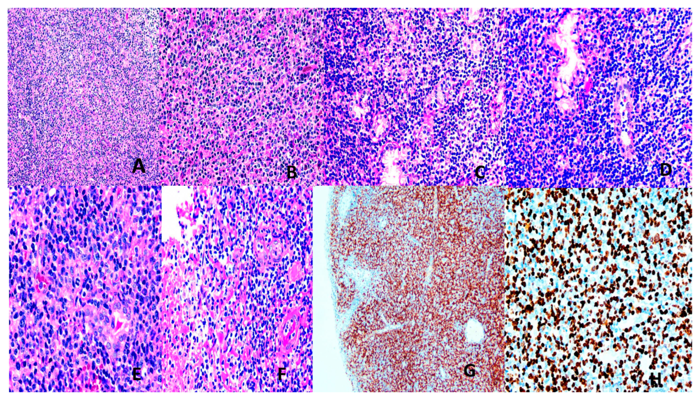 Vaccines 13 00911 g004 Vaccines 13 00911 g004