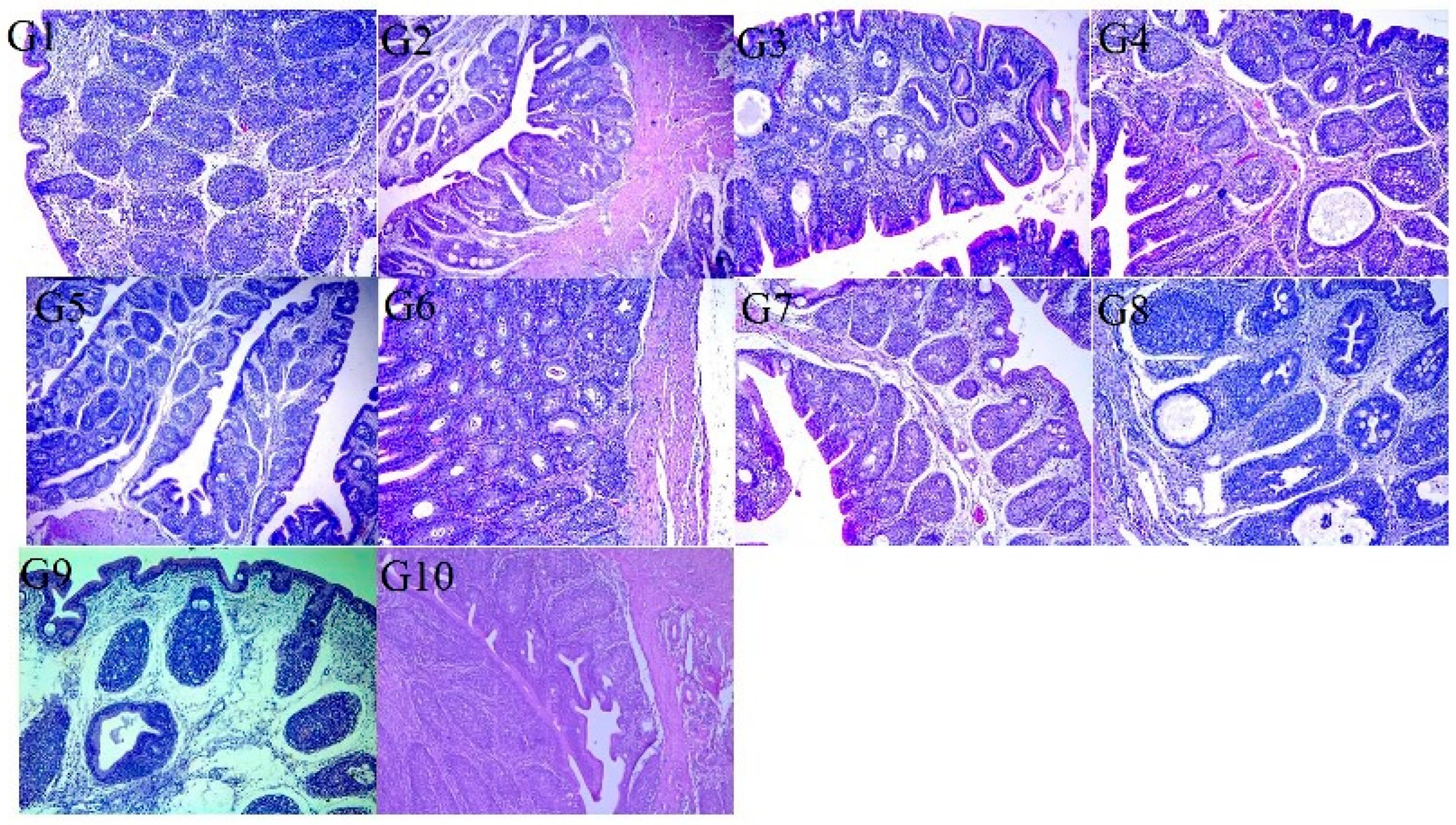 Vaccines 13 01132 g004 Vaccines 13 01132 g004