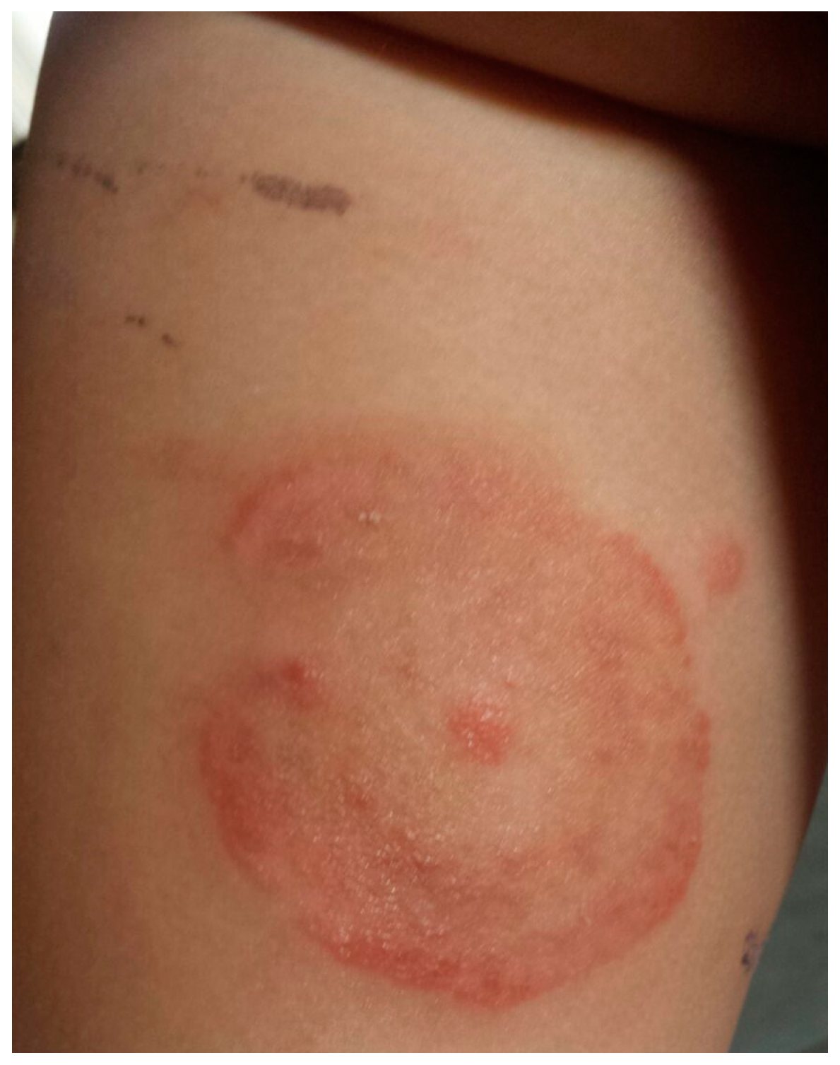 Veterinary Sciences Free Full Text Infection by Microsporum