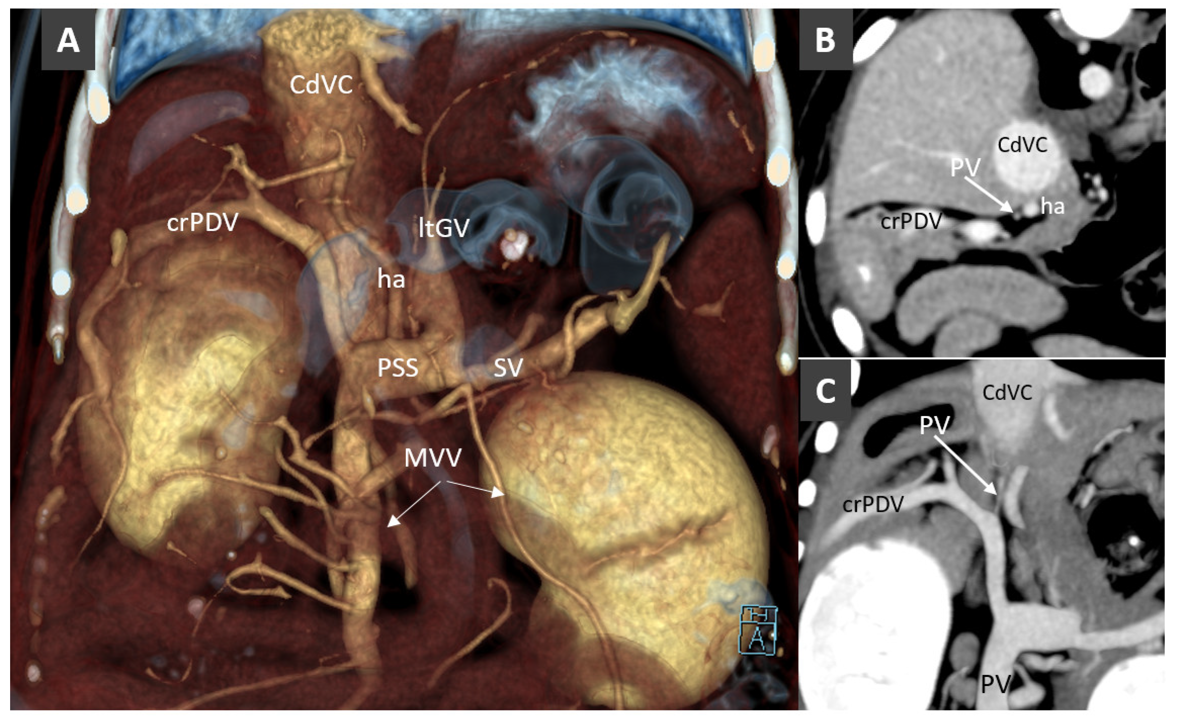 Veterinary Sciences Free Full Text Anomalies Of The Portal Venous System In Dogs And Cats As Seen On Multidetector Row Computed Tomography An Overview And Systematization Proposal Html