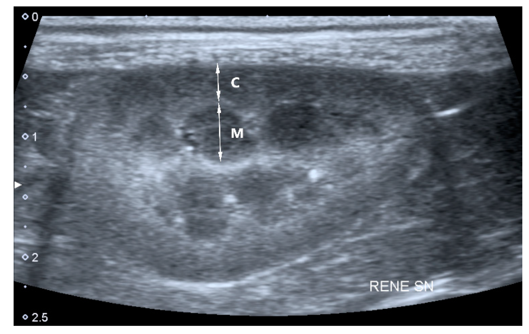 Veterinary Sciences Free FullText How Ultrasound Can Be Useful for Staging Chronic Kidney