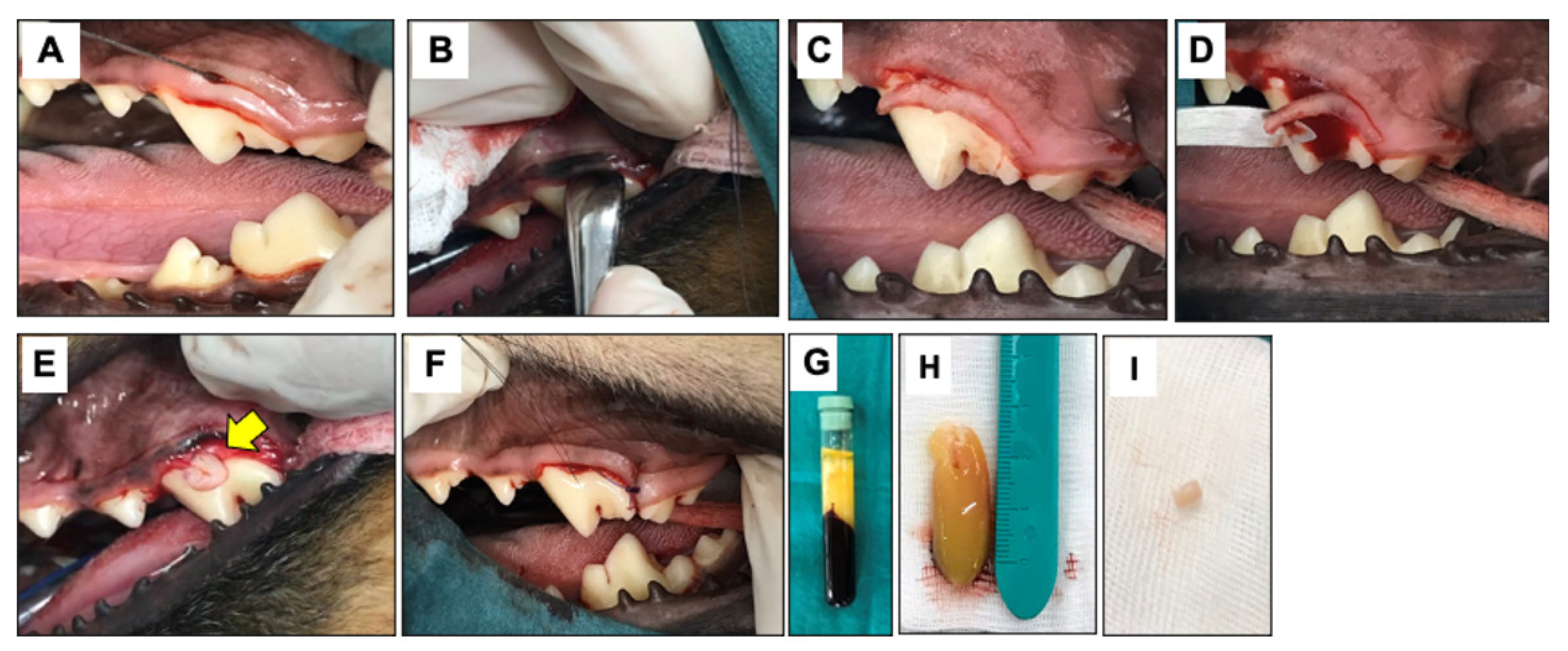 Evaluation of the Use of Platelet-Rich Fibrin Xenologous