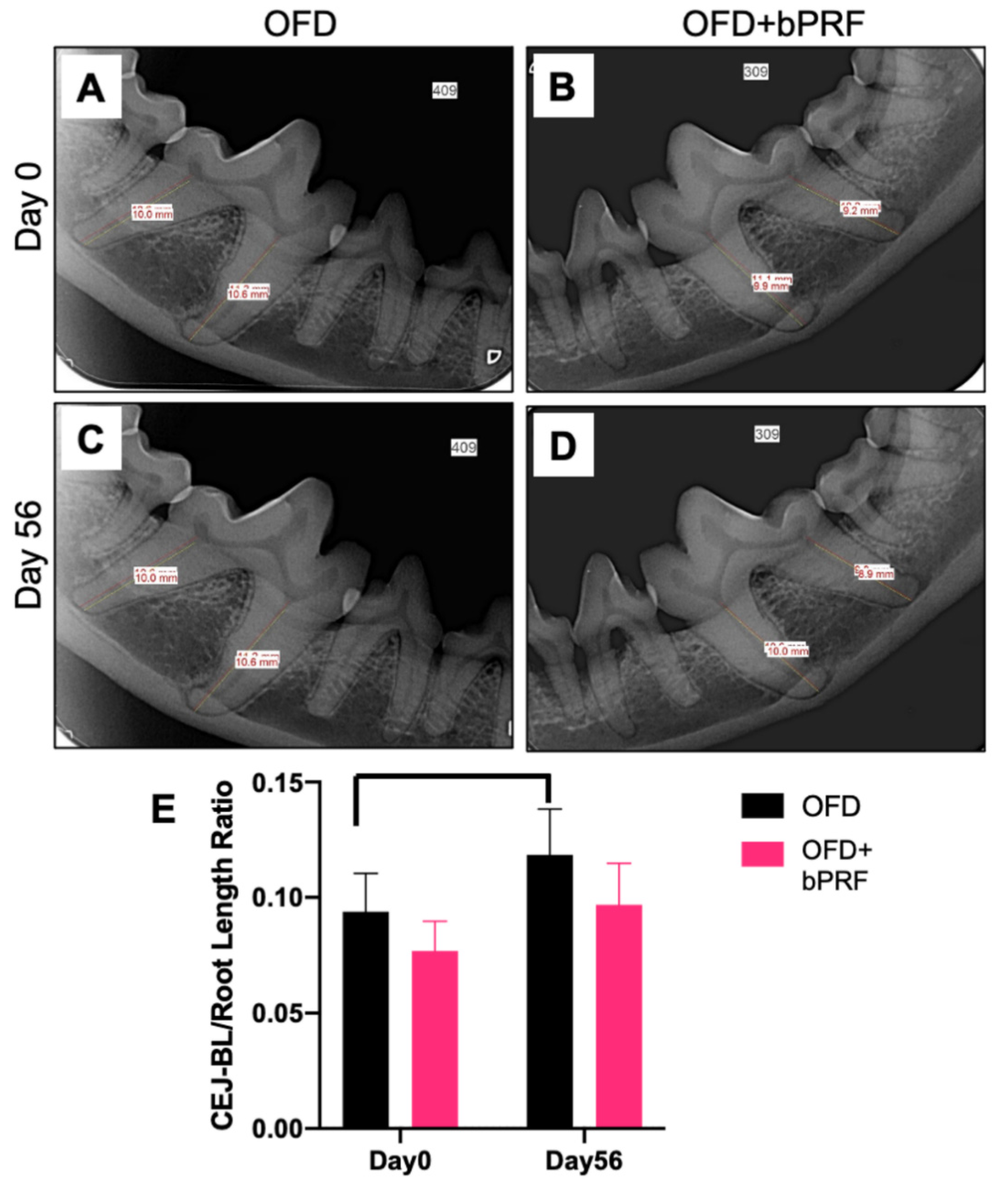 ペリオドンタル・デブライドメント = Periodontal debridem… 超音波”を攻略せよ ペリオドンタル・デブライドメント プラス1