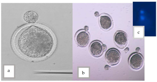 レコード Notch Signaling Pathway in Tooth Shape Variations throughout