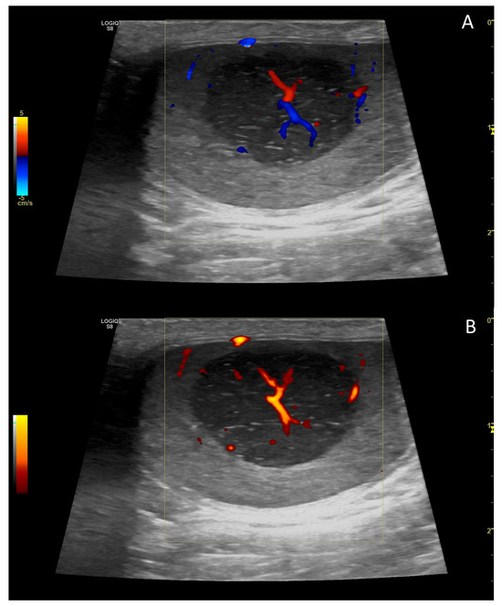 Ultrasound-Based Technologies for the Evaluation of Testicles in the ...