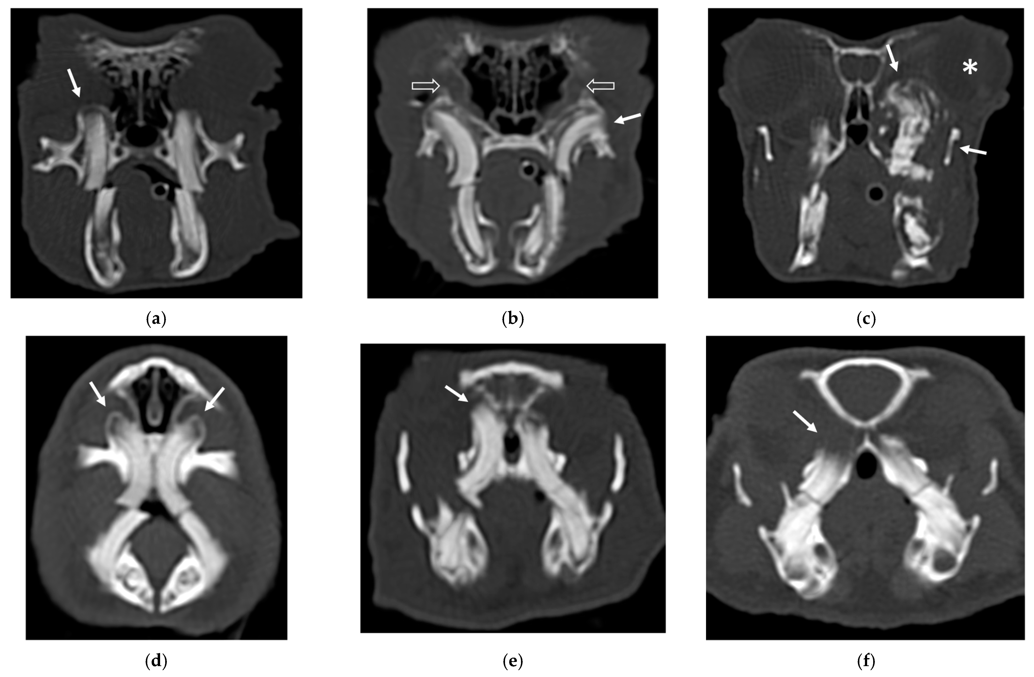 The X-ray scanner is used to investigate a discrepancy in sex