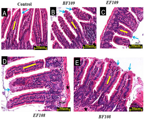 ギルト Effects of Bacteroides fragilis and Enterococcus faecium