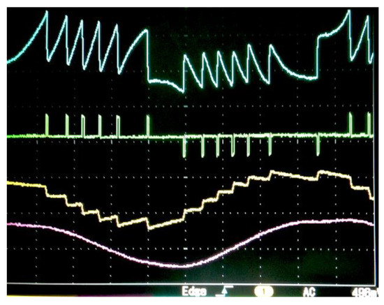 vibration herzgegend Vibration Unit Converter