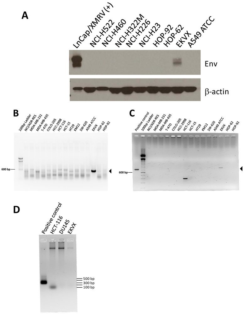Mer and Axl RTKs are expressed in human non-small cell 