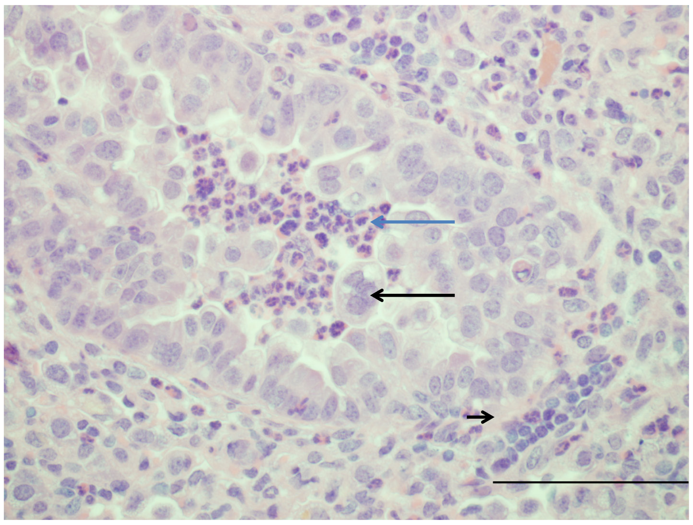 Syncytial virus