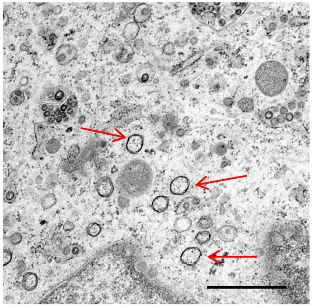 Viruses | Free Full-Text | Involvement of Autophagy in Coronavirus Replication | HTML1024 x 1007