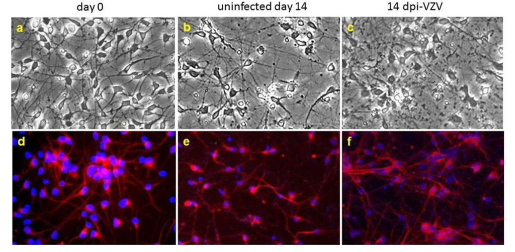 virus zoster varicella vzv human viruses infection effect cytopathic cpe interaction text neuron phase mdpi g001 figure