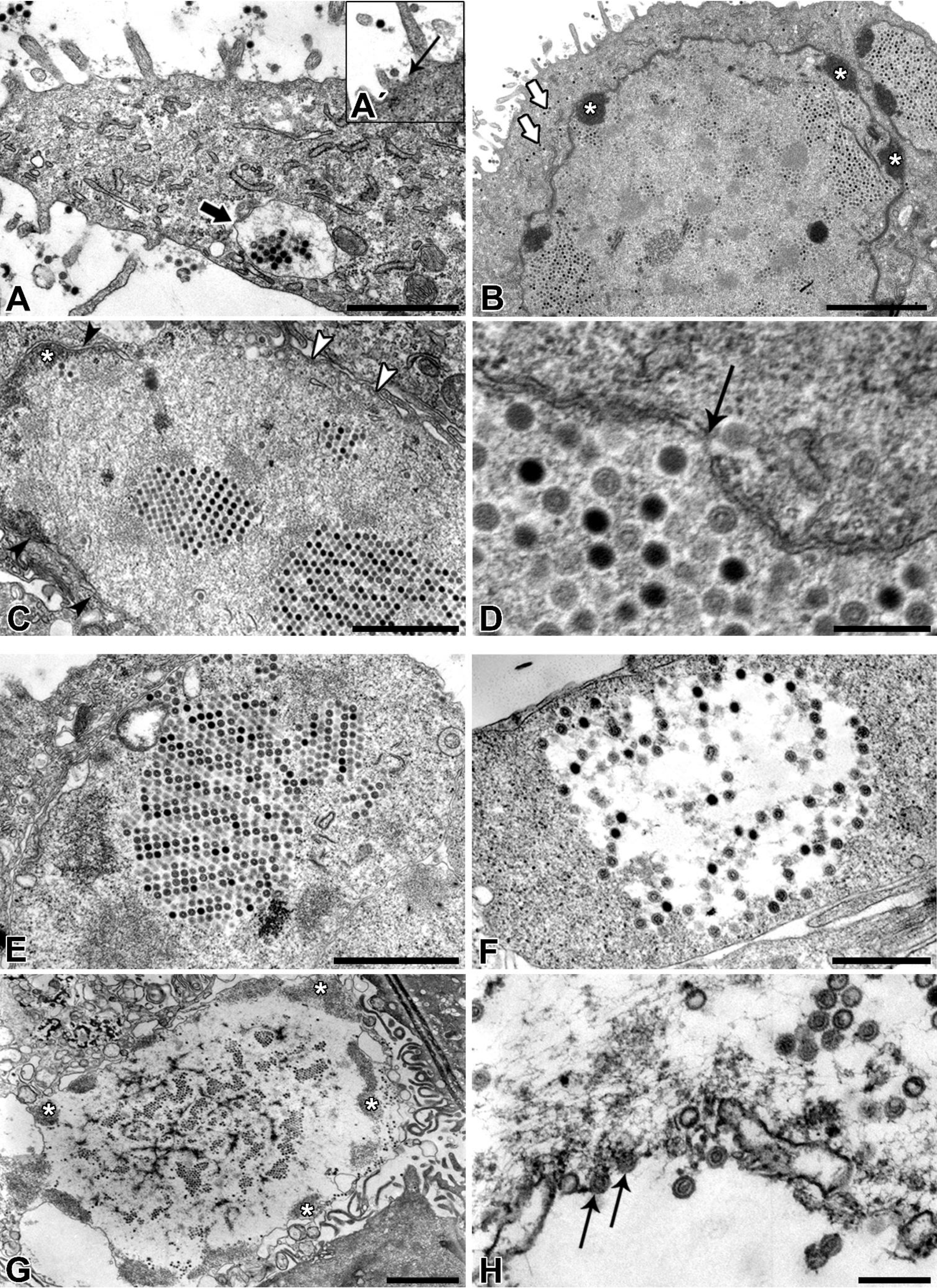 Viruses 06 02505 g005 1024