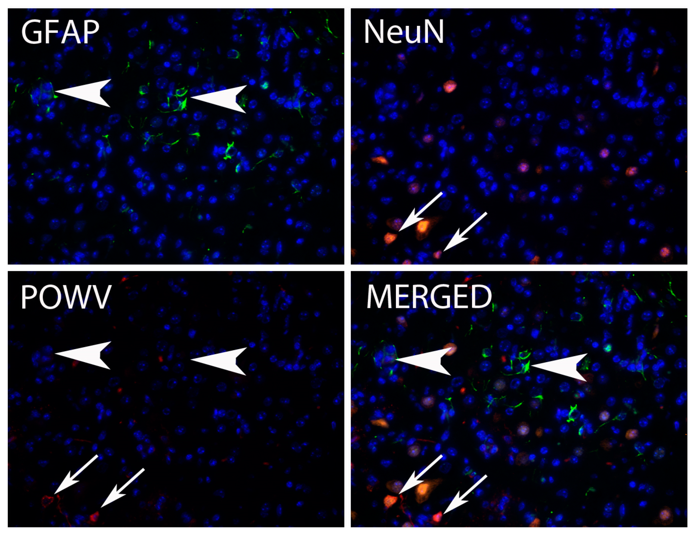 Viruses 08 00220 g004 1024