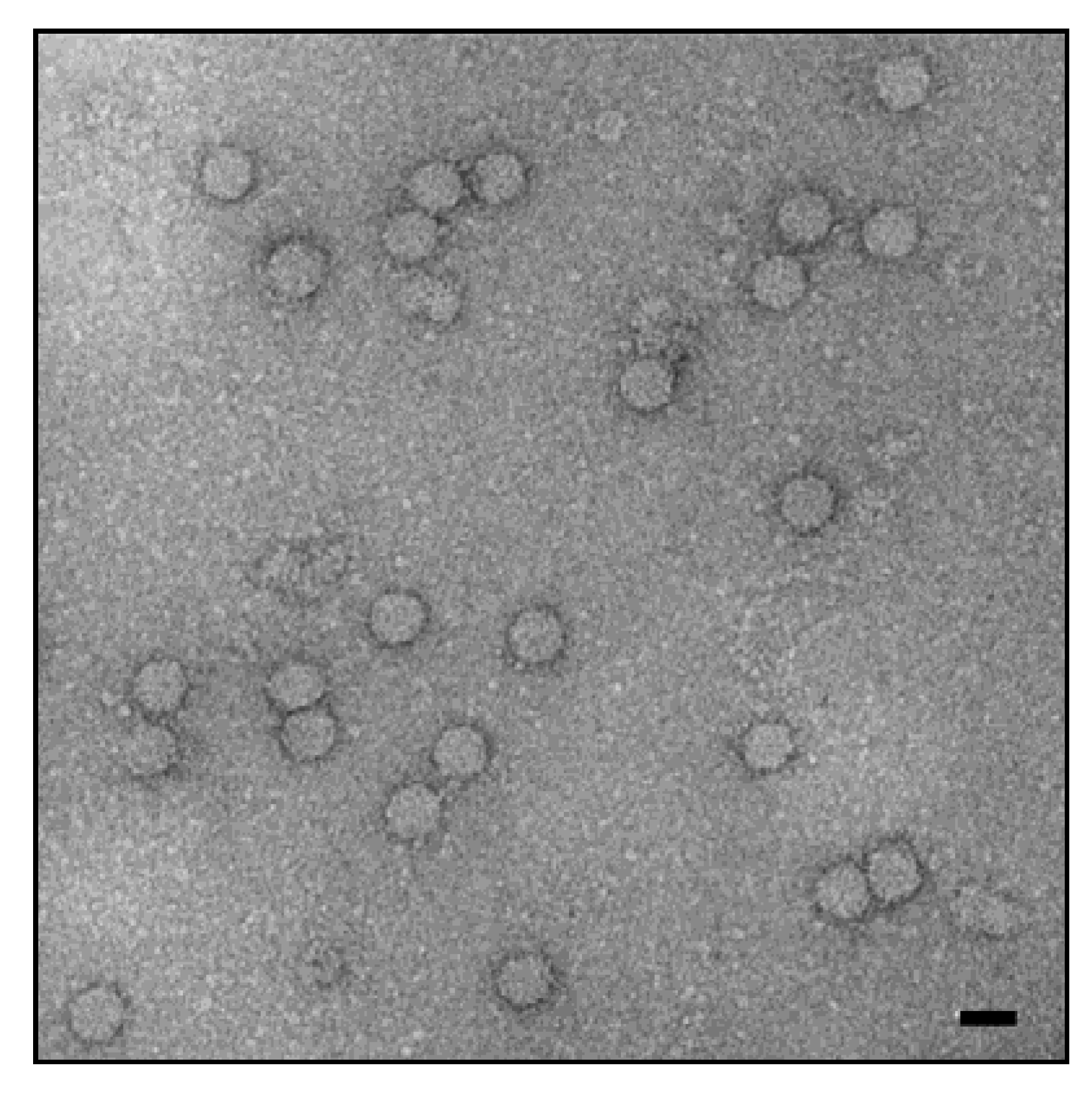 Viruses Free FullText Porcine Circoviruses and Xenotransplantation