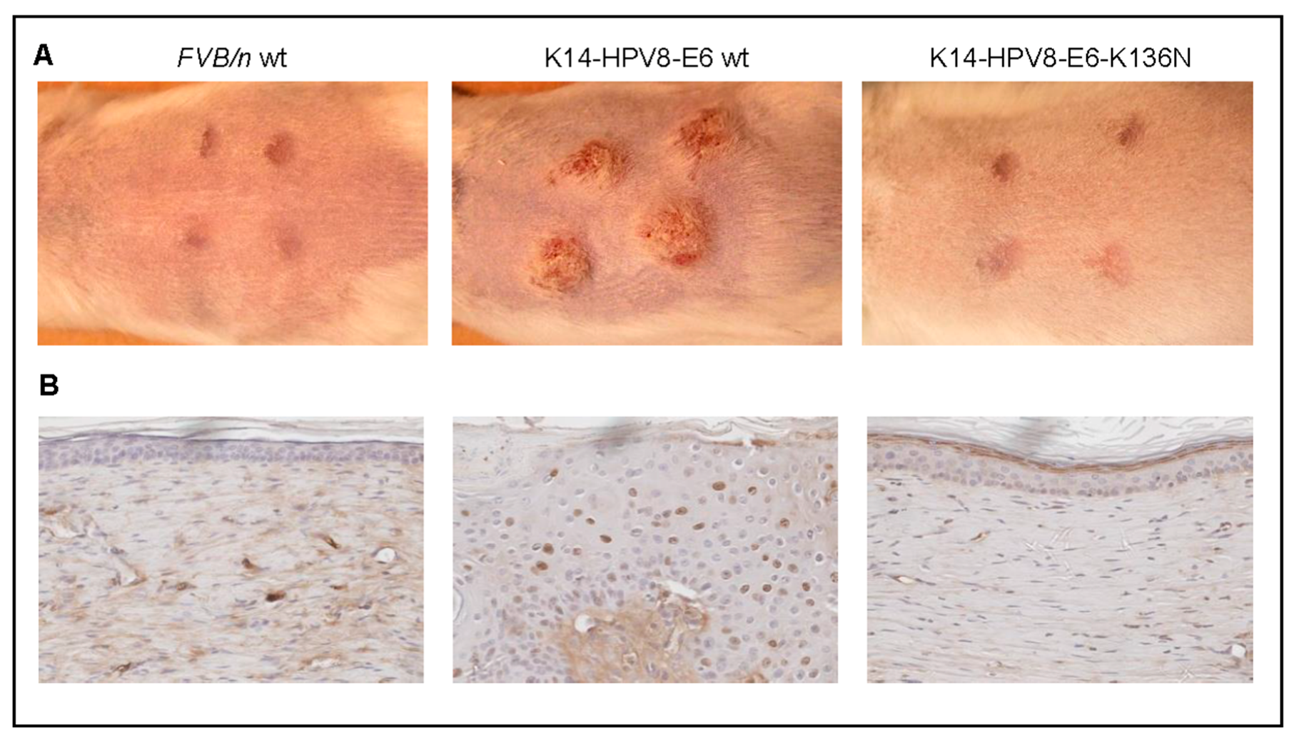 papilloma skin virus)