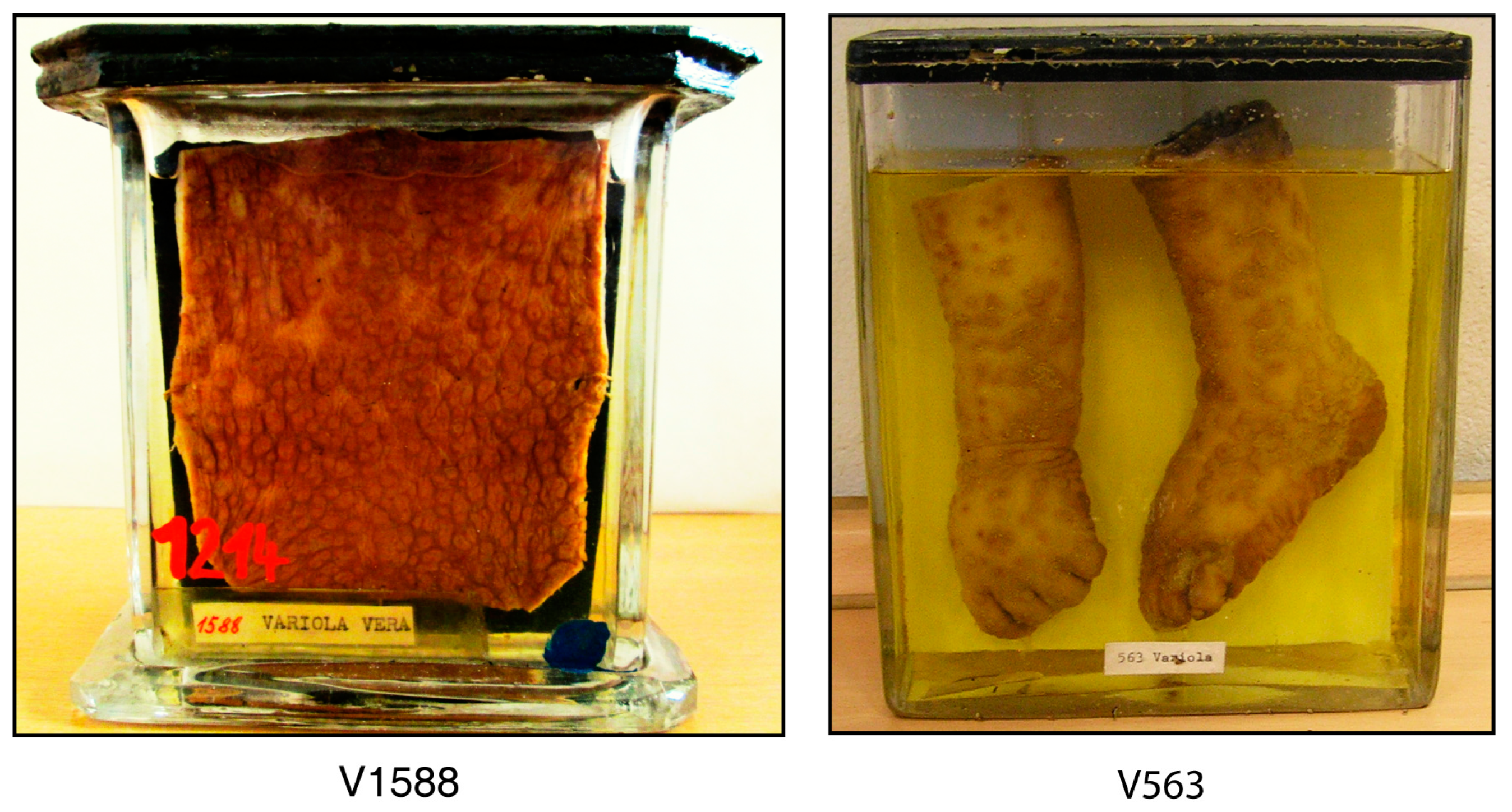 Viruses | Free Full-Text | Characterization of Two Historic Smallpox  Specimens from a Czech Museum
